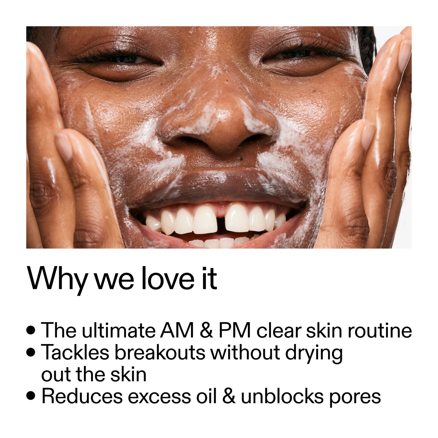 intro-routine-for-acne-f8 Intro_Routine_for_Acne_Why_we_love_it_2000x2000_42499e10-4629-4a0e-a627-7e215f4da6bc.jpg