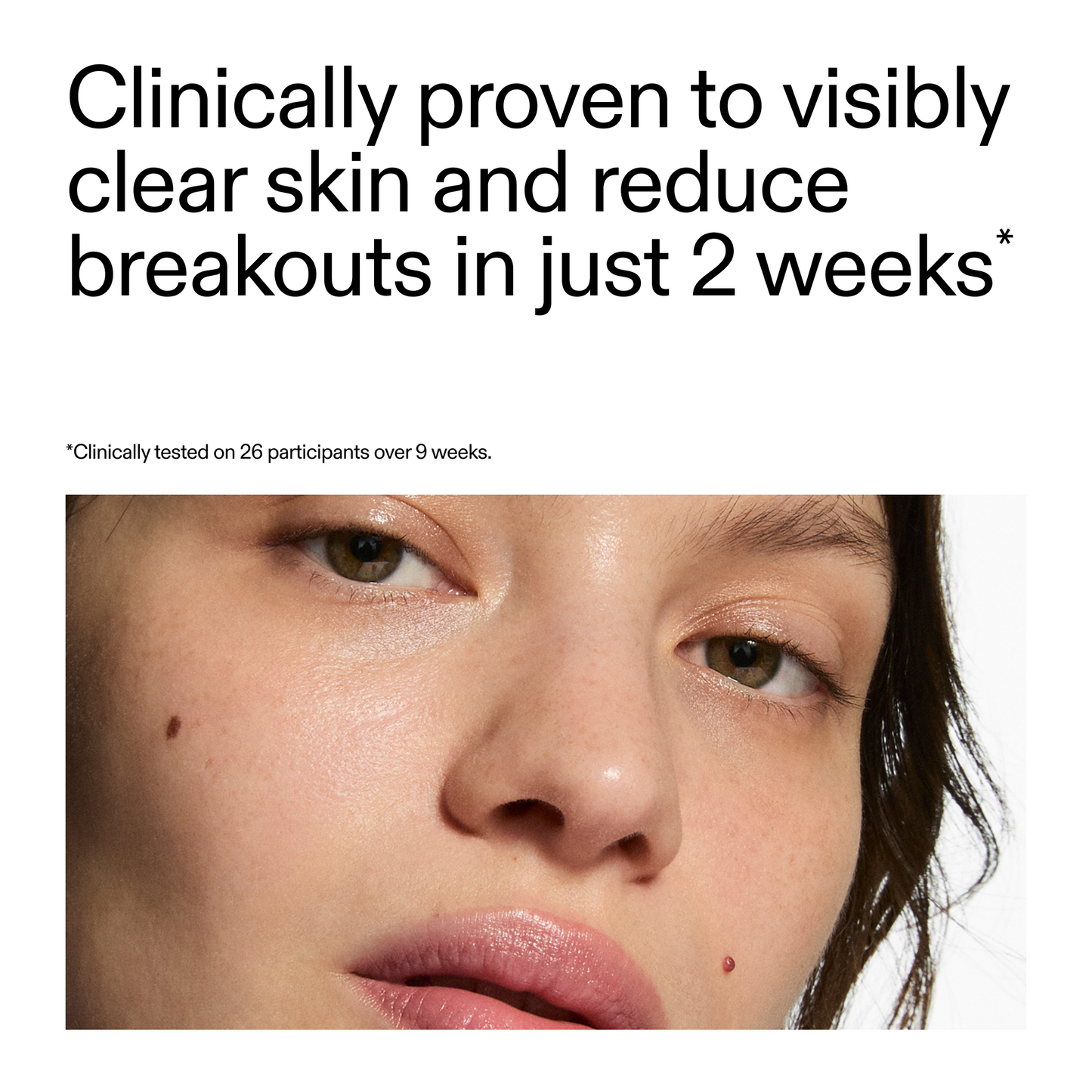 360-acne-clearing-serum-y4 360_Serum_Key_Claim.png