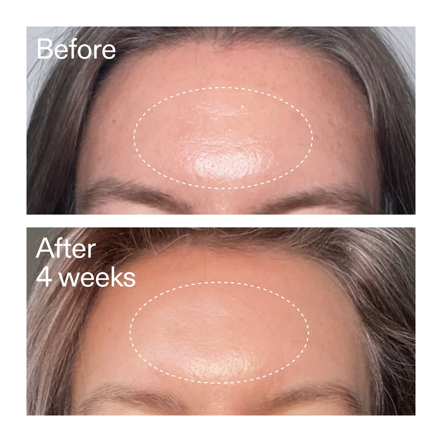 advanced-0-2-retinal-serum-c7 AdvancedRetinal_BeforeAfter1_2000x2000_1da6bb0a-29dd-41d1-95b7-8679696bbf0f.jpg