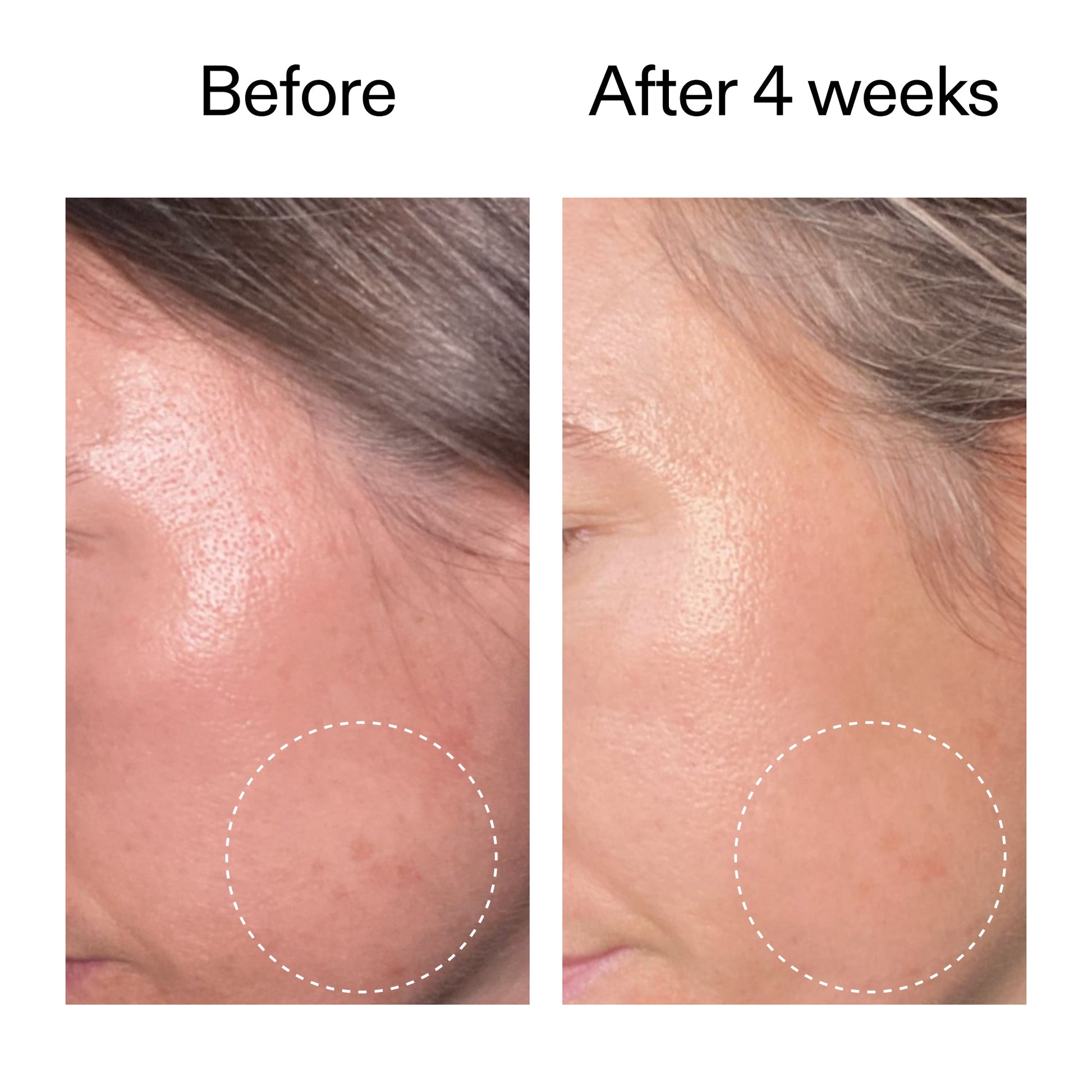 advanced-0-2-retinal-serum-duo-r7 AdvancedRetinal_BeforeAfter2__2000x2000_8ef75542-2316-4814-81ee-0f66a85912bc.jpg