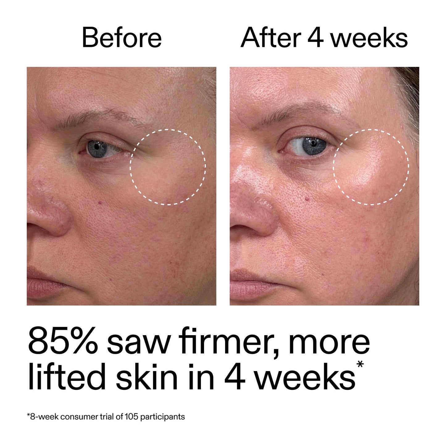 advanced-0-2-retinal-serum-c7 AdvancedRetinal_BeforeAfter_Claim1_2000x2000_bcc385c4-5e73-4f1e-aba8-64267937d0d3.jpg