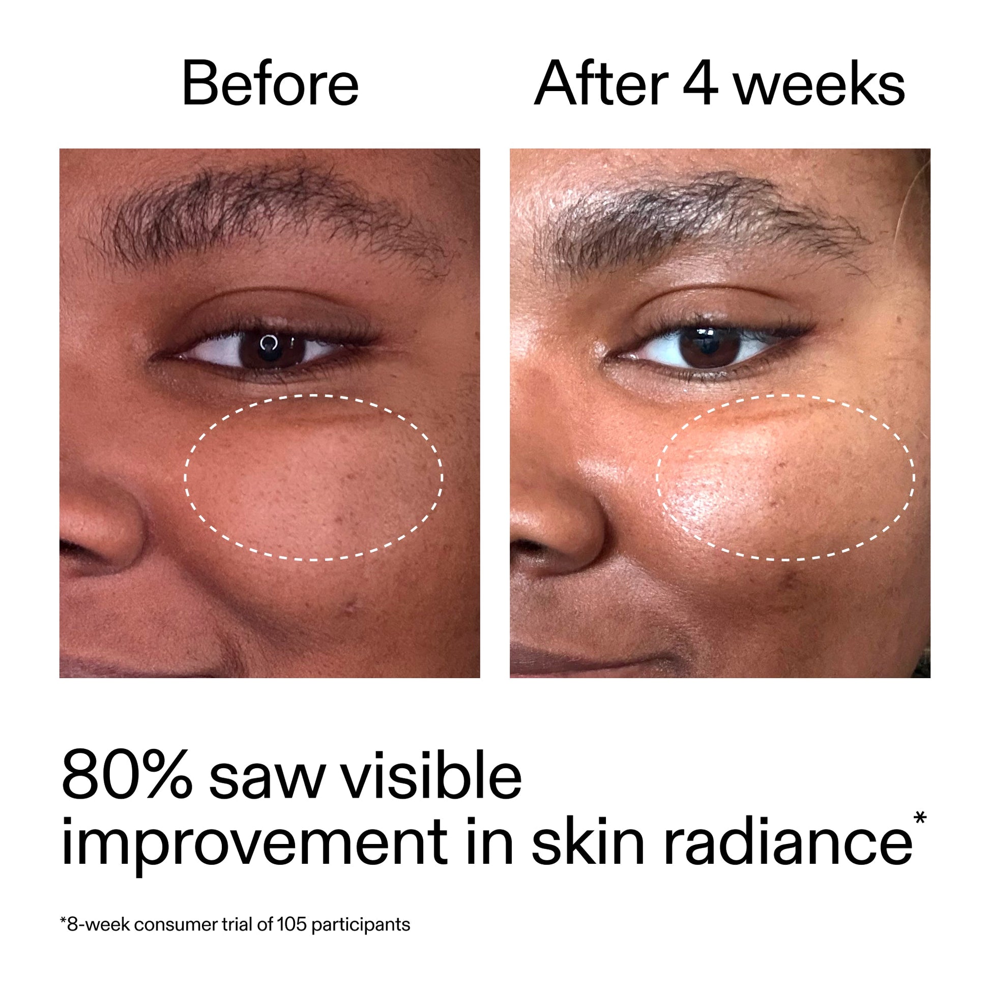 advanced-0-2-retinal-serum-c7 AdvancedRetinal_BeforeAfter_Claim2_2000x2000_39d11e3d-eda9-44ec-ab32-2903b1a368bd.jpg