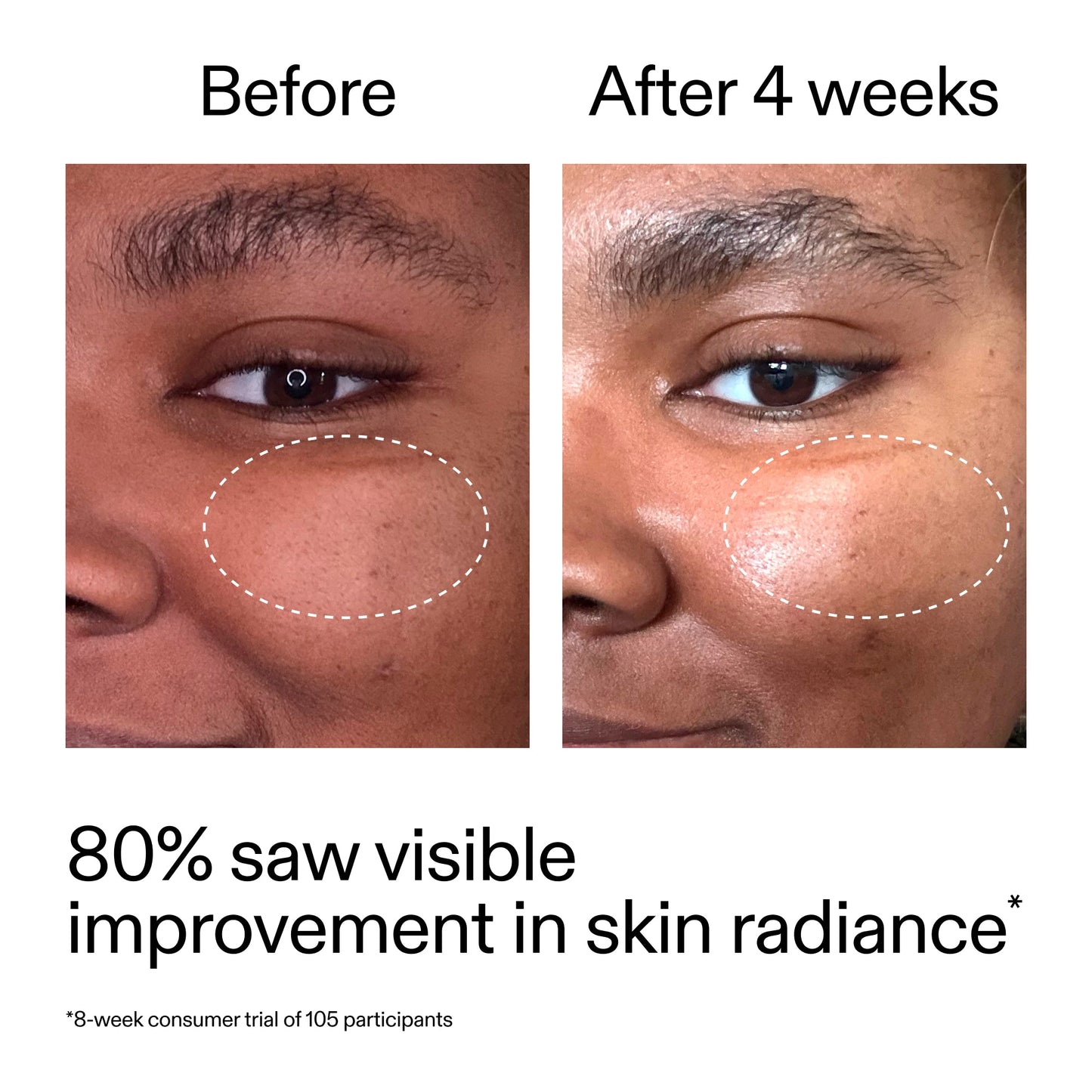 advanced-0-2-retinal-serum-duo-r7 AdvancedRetinal_BeforeAfter_Claim2_2000x2000_681b621d-8d44-4d44-9a40-89244f9b2e53.jpg