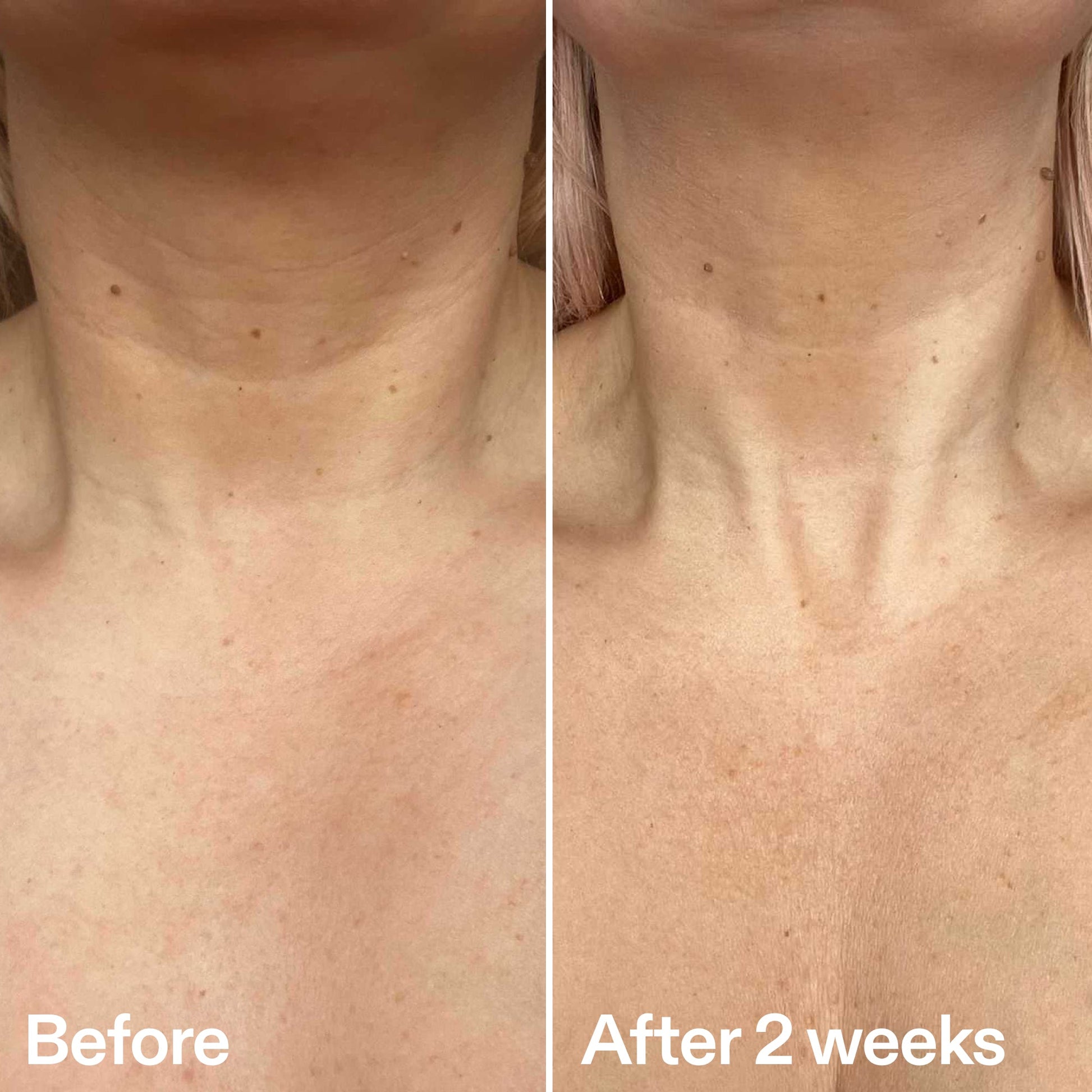 bio-active-neck-lift-stick-n4 B_A_2.jpg