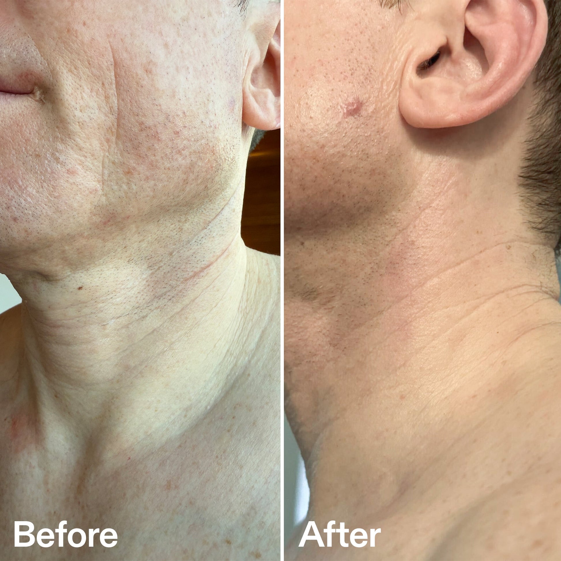 bio-active-neck-lift-stick-n4 B_A_afa2743e-b8e2-4504-92f4-e281cb6cf759.jpg