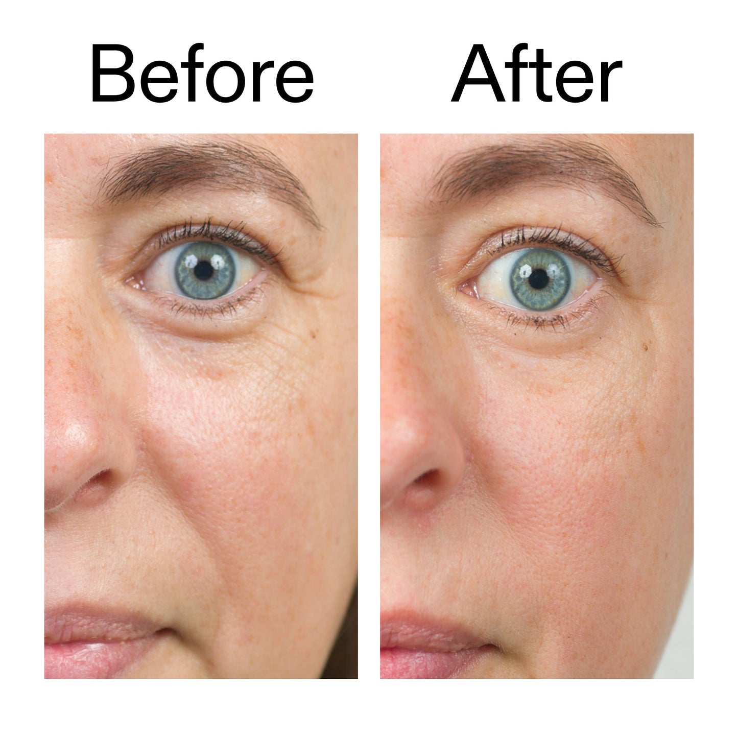 bio-active-ceramide-moisturizer-duo-w1 Bio-Active_Before_After_2000x2000_566e5a9e-135e-417a-8242-b44e5fa35463.jpg