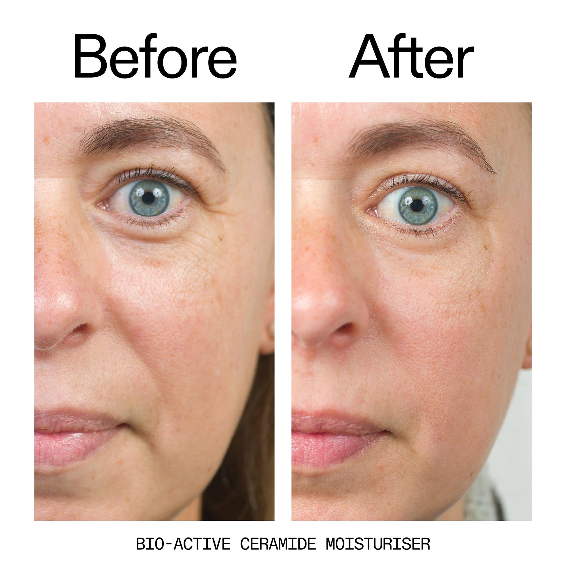 barrier-boosting-trio-o6 Bio-Active_Before_After_2000x2000_600947b4-e8c5-425a-9155-fc15bc83aa12.jpg