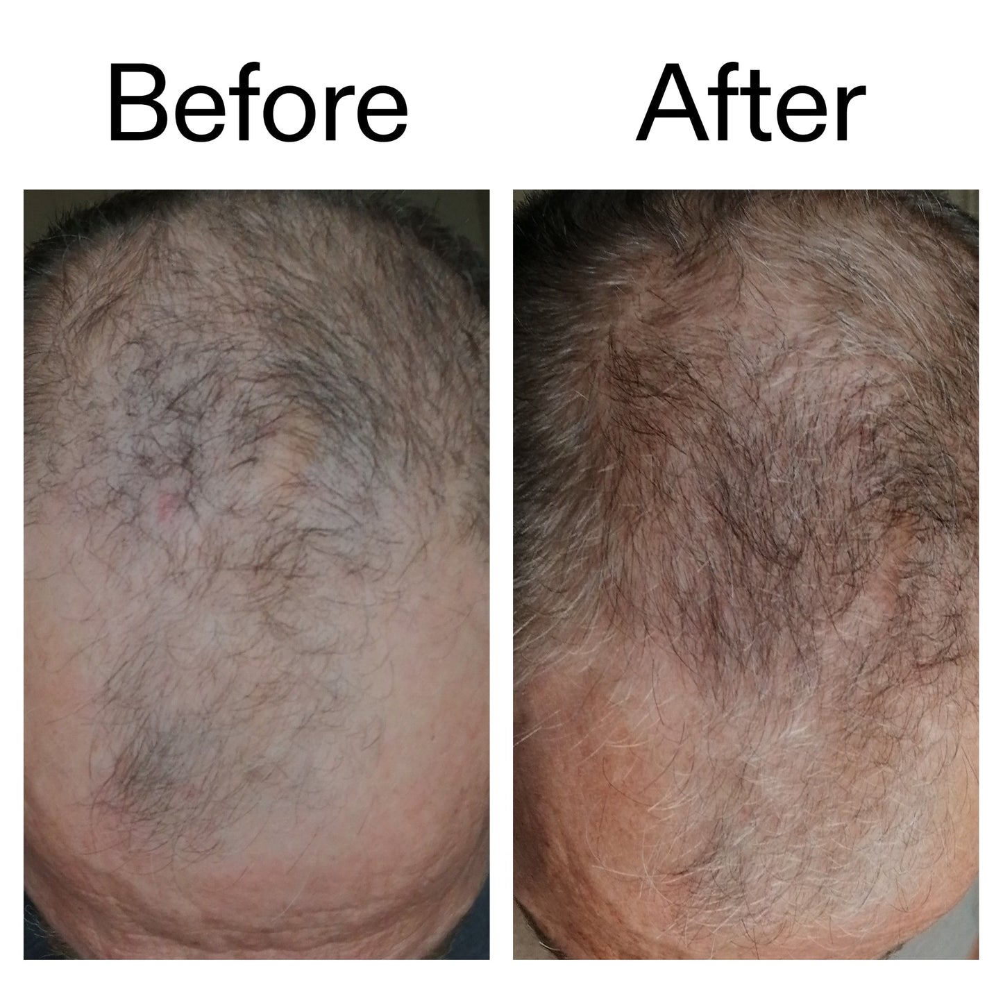 3-month-hair-growth-trio-i8 Caffeine_Scalp_Treatment_B_A_Ppage_2000_x_2000.jpg