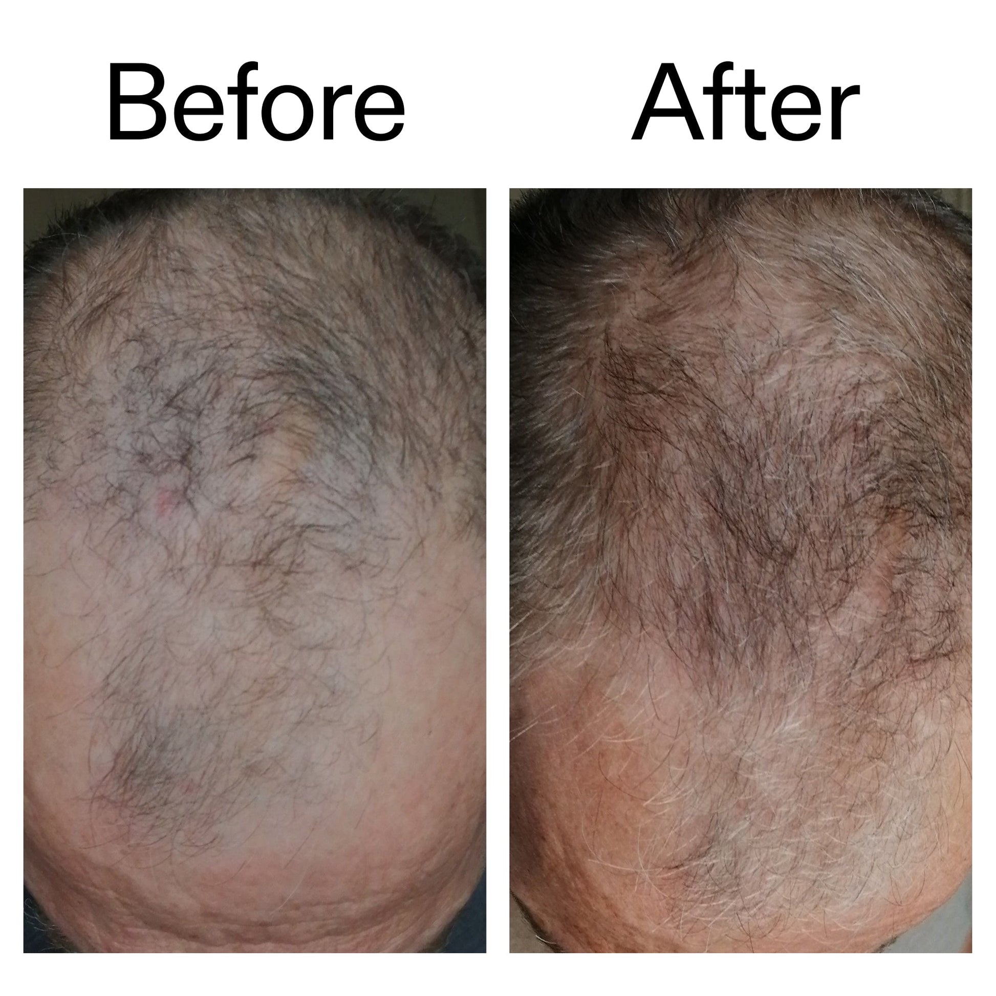 3-month-hair-growth-trio-i8 Caffeine_Scalp_Treatment_B_A_Ppage_2000_x_2000.jpg