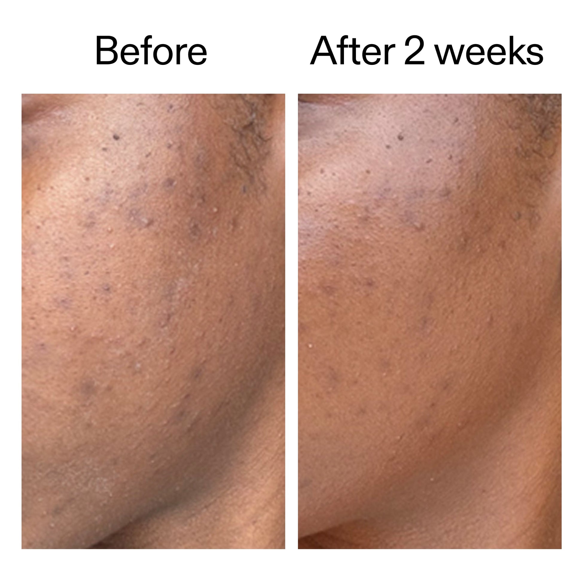 360-acne-clearing-serum-y4 DIOICB_A2000x2000.jpg