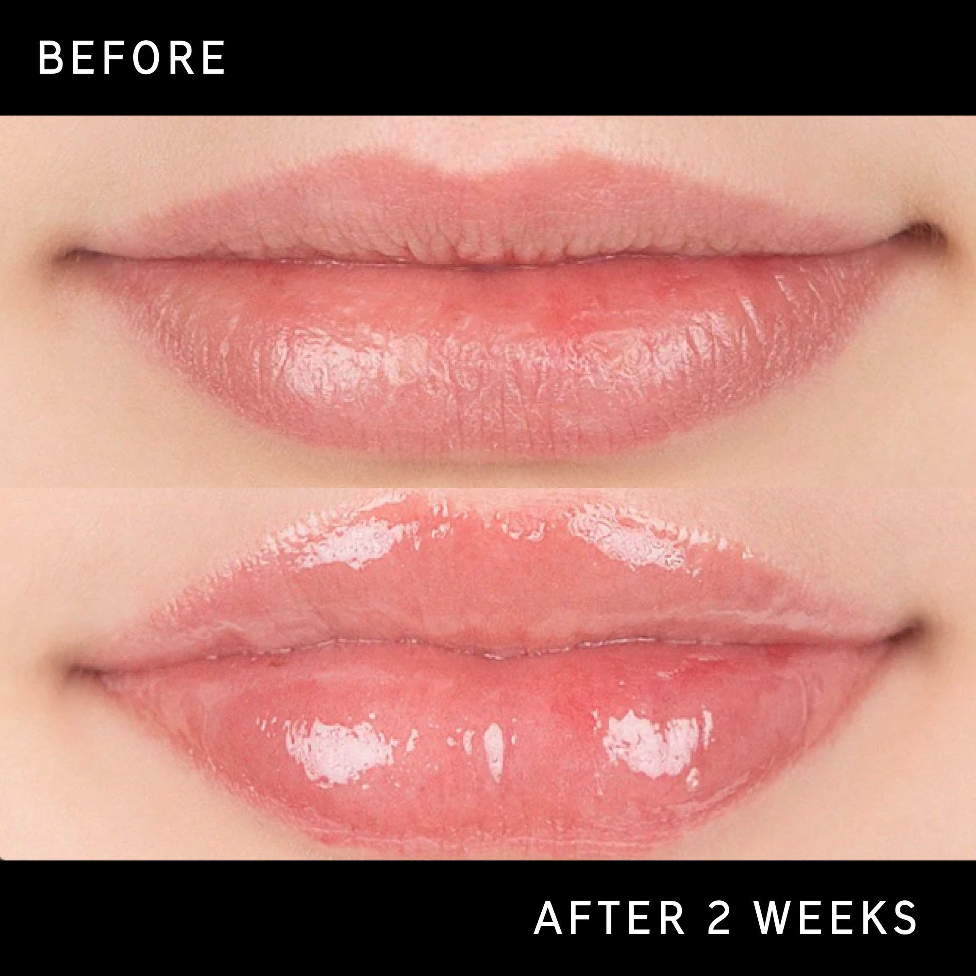 lip-plumping-duo-w3 DTC-Top15_Amends_Tripeptide-Lip_B_A.jpg