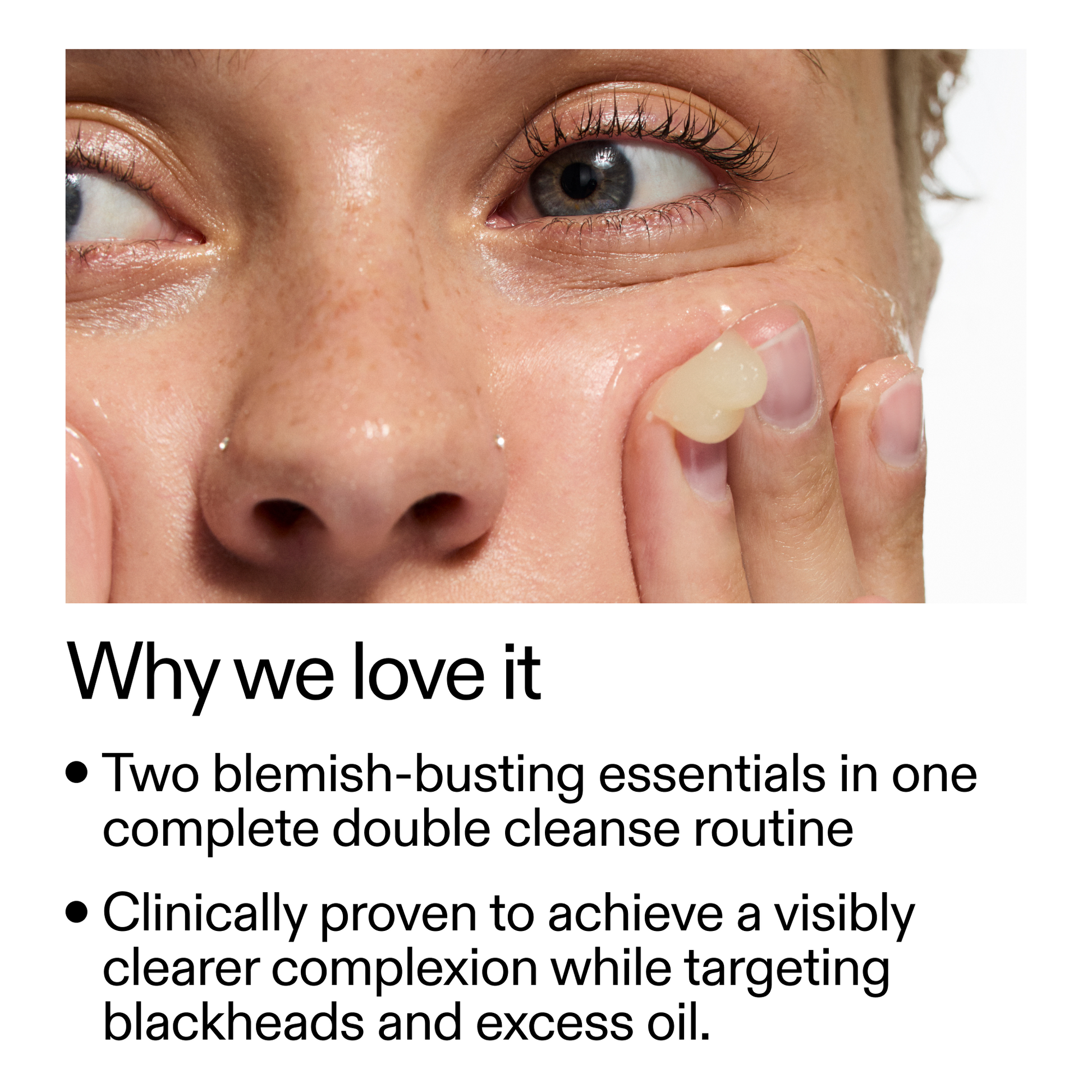 acne-double-cleanse-duo-w6 Double_Cleanse_Duo_for_Breakouts_Why_We_2000x2000_f242cb12-bb5c-487c-b203-071ccb406ec5.png