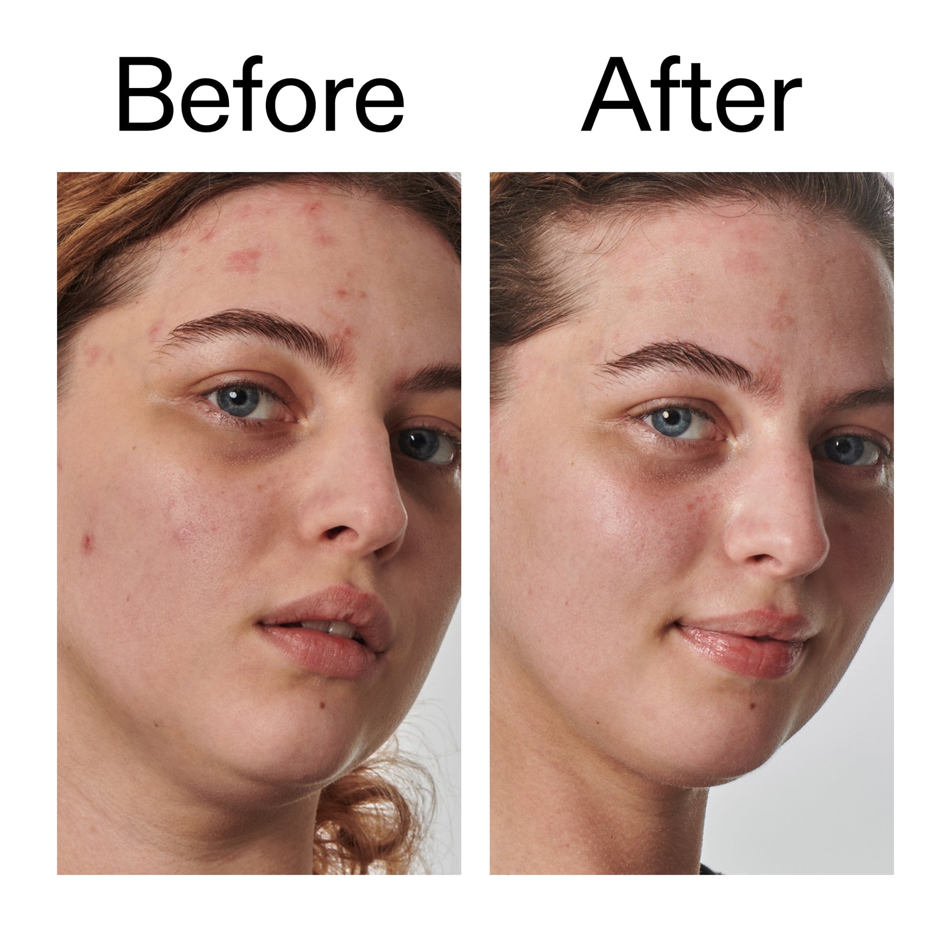 10-urea-moisturizer-n4 Dry_and_Rough_Skin_Solution_Before_After_2000x2000_efa6e639-5c39-49bd-a5dd-f0220293120a.jpg
