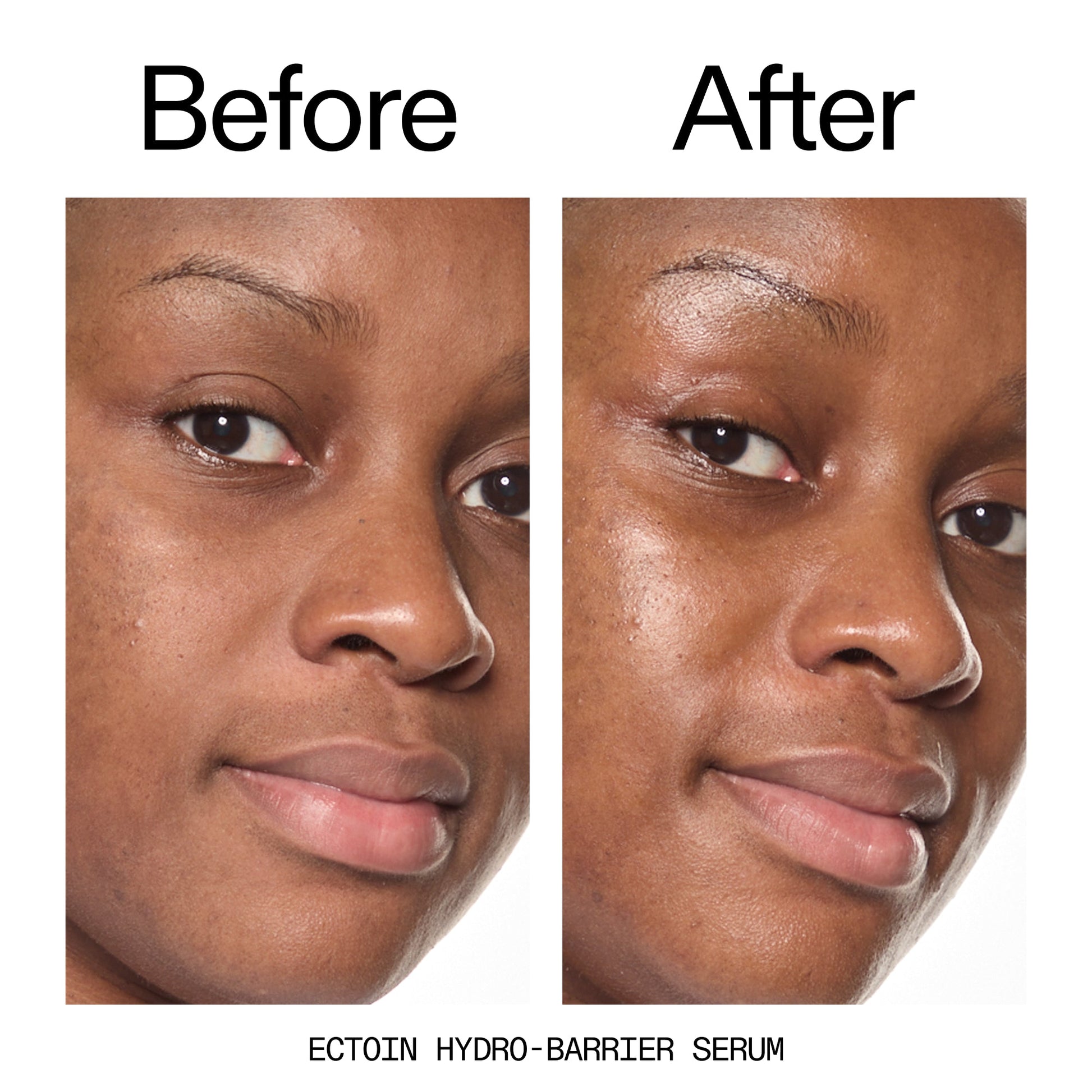 barrier-boosting-trio-o6 Ectoin_Before_After_2000x2000_ce35bc41-4da0-4b6f-adc7-29f8641f6c6c.jpg