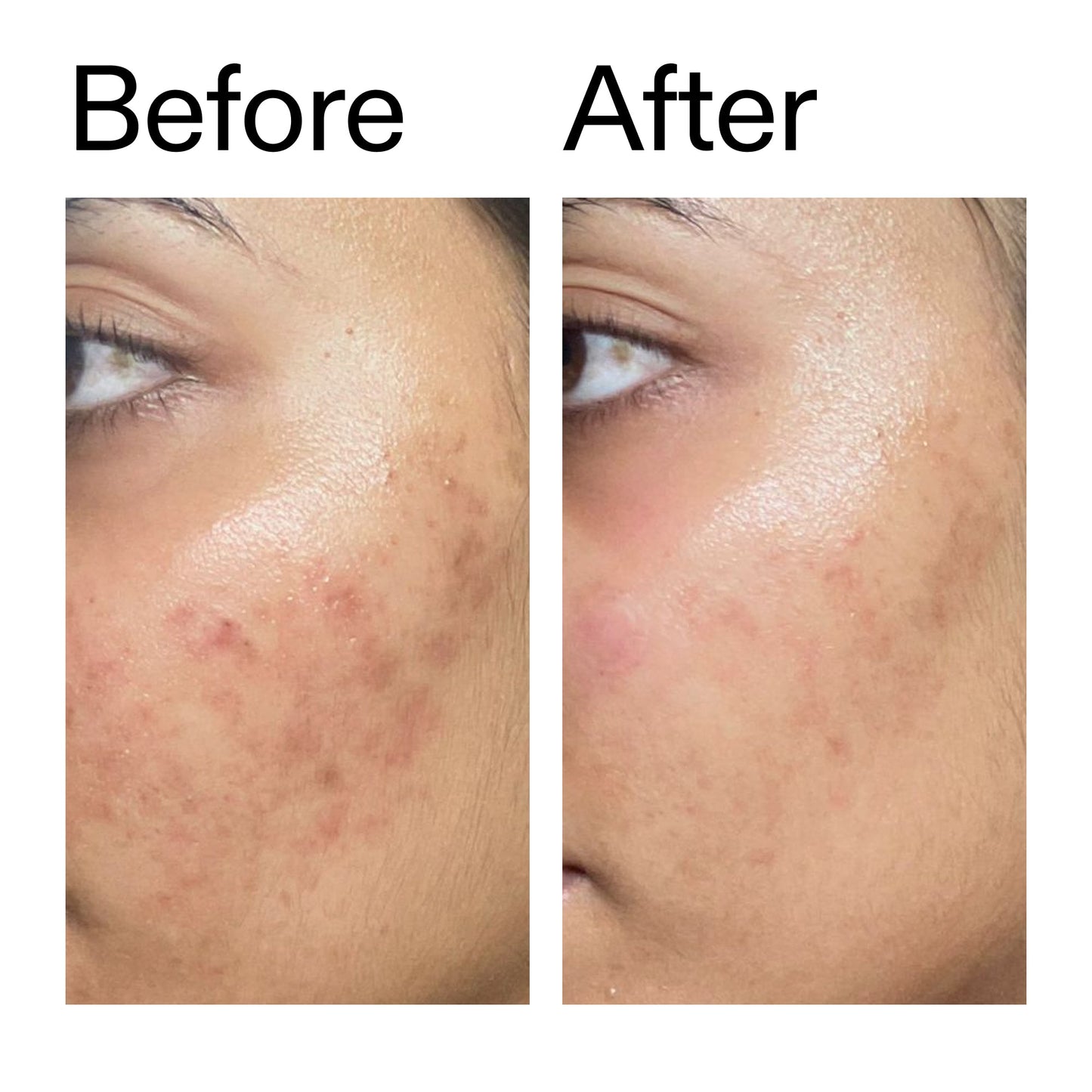 ectoin-hydro-barrier-serum-s6 Ectoin_Hydro-barrier_Serum__Before_After_2000x2000_34261920-d004-48d0-9c7b-8e1c15971bfd.jpg