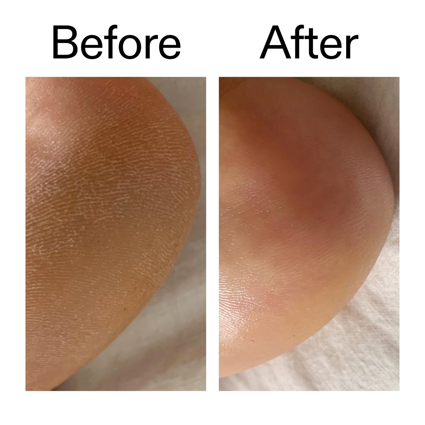 glycolic-acid-exfoliating-body-stick-n8 Glycolic_Acid_Exfoliating_Body_Stick_Before_After_V1_2000x2000_a3043625-9400-429a-a7fb-d6dbd220f722.jpg