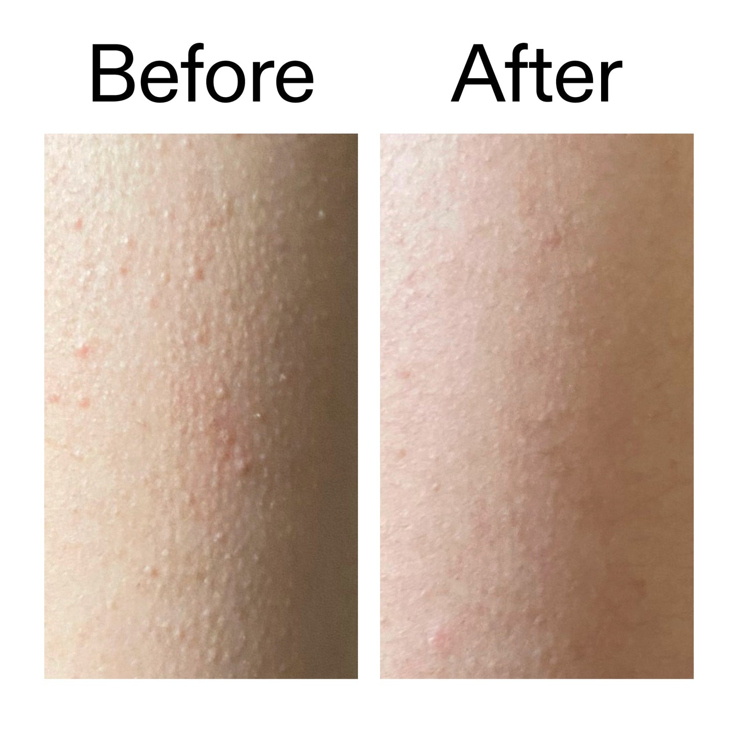 glycolic-acid-exfoliating-body-stick-n8 Glycolic_Acid_Exfoliating_Body_Stick_Before_After_V2_2000x2000_2e4ba052-94f6-4d56-82df-7bdb5b2df7ae.jpg