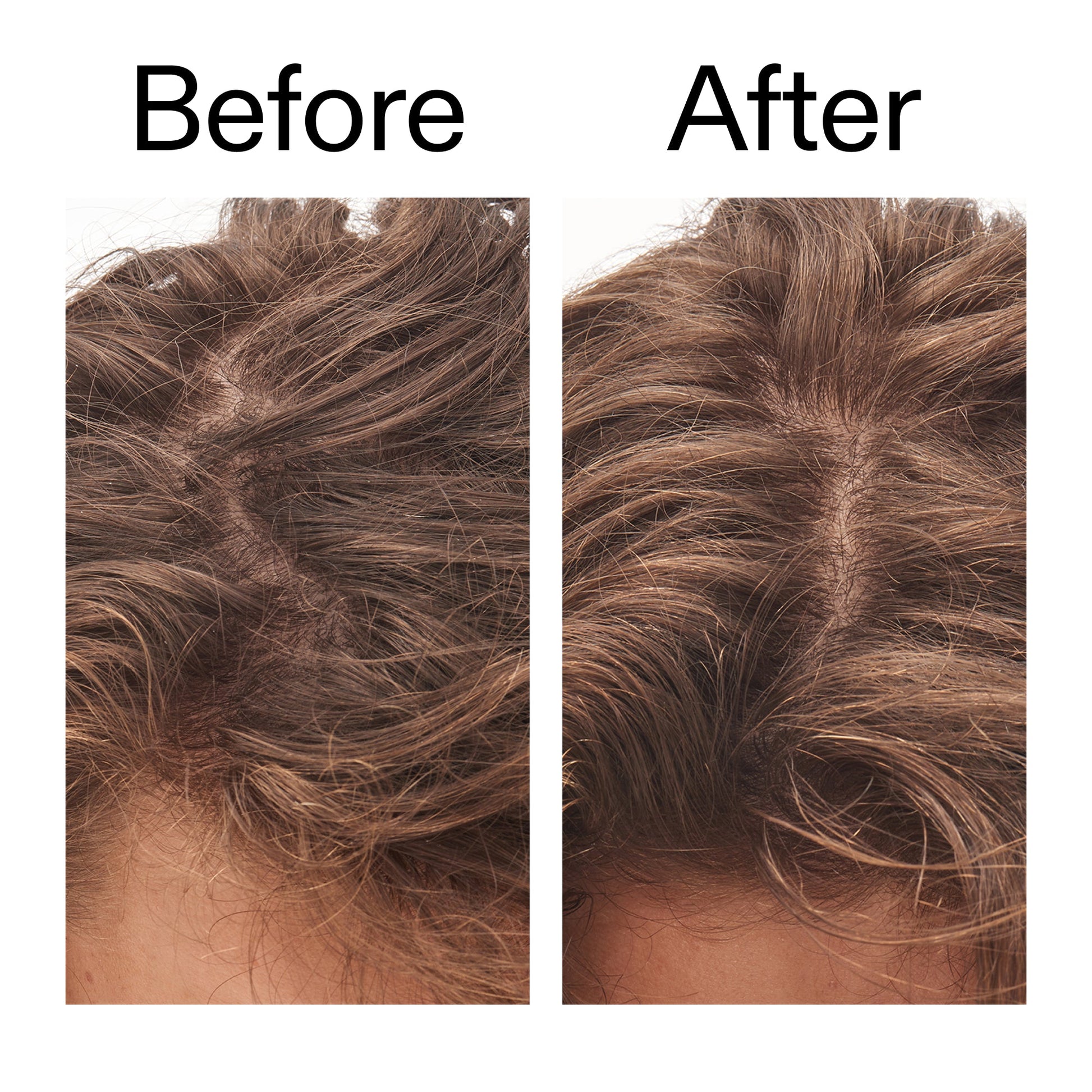 glycolic-acid-exfoliating-scalp-scrub-x1 Glycolic_Acid_Exfoliating_Scalp_Scrub_Before_After_2000x2000_b8561c87-05a1-4caa-80f7-1b6b33d750f7.jpg