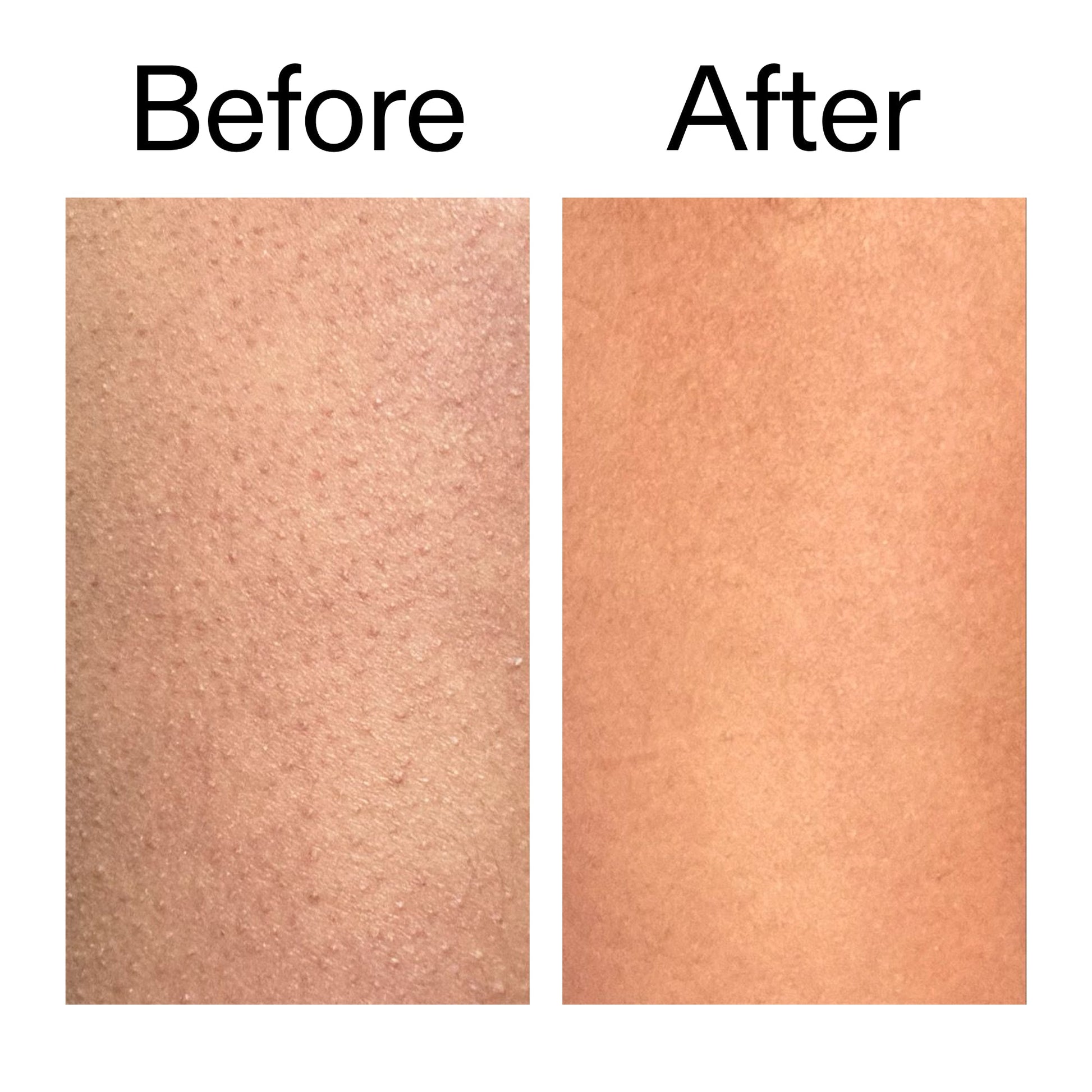 glycolic-acid-exfoliating-body-stick-n8 Glycolic_Body_Stick_B_A_2000x2000_6e6e6b4d-5bd7-43c0-aeed-4d66788e8995.jpg