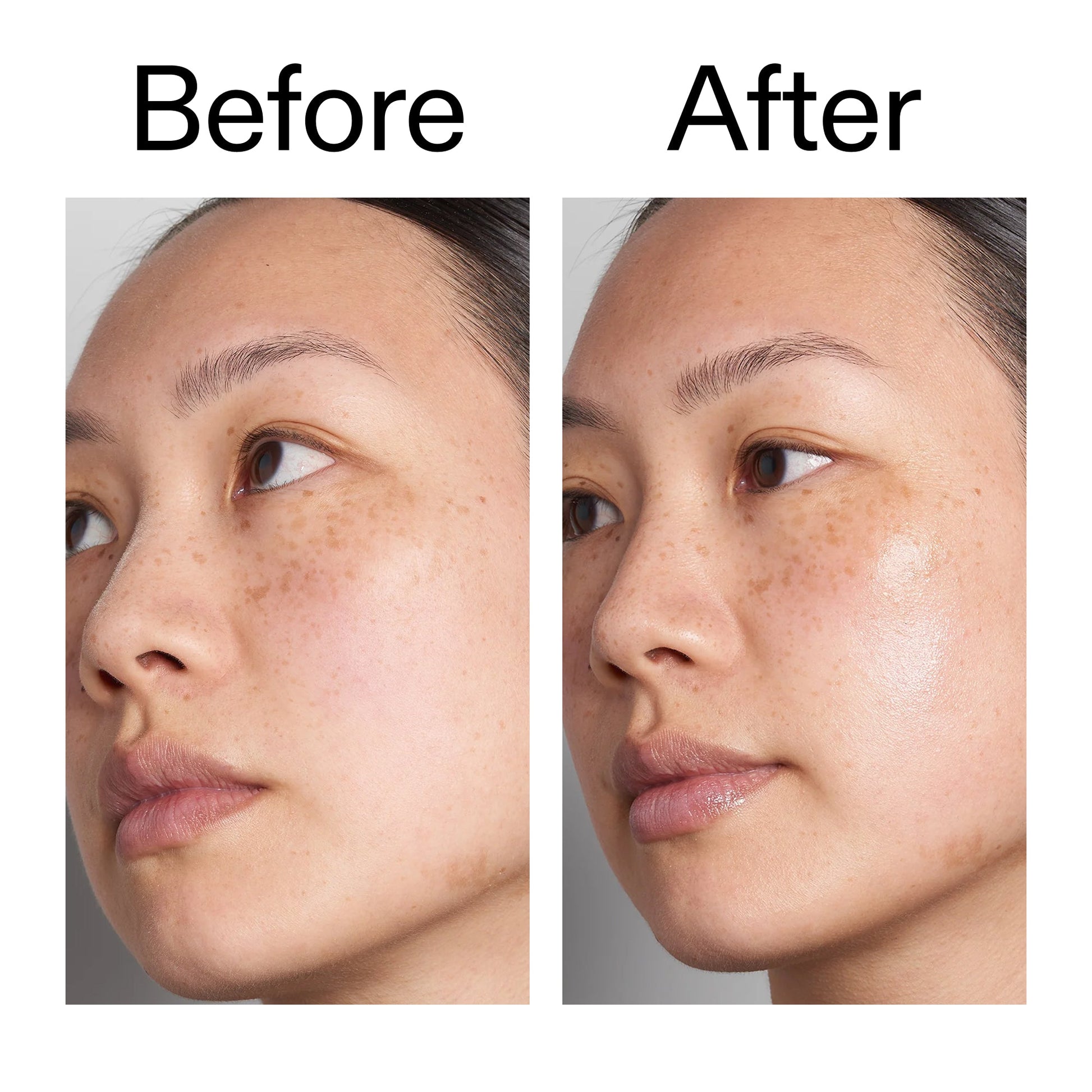 hyaluronic-acid-serum-60ml-n8 Hyaluronic_Acid_Before_After_2000x2000_d7983956-8aa2-4ea3-8255-c63e8d4f892e.jpg