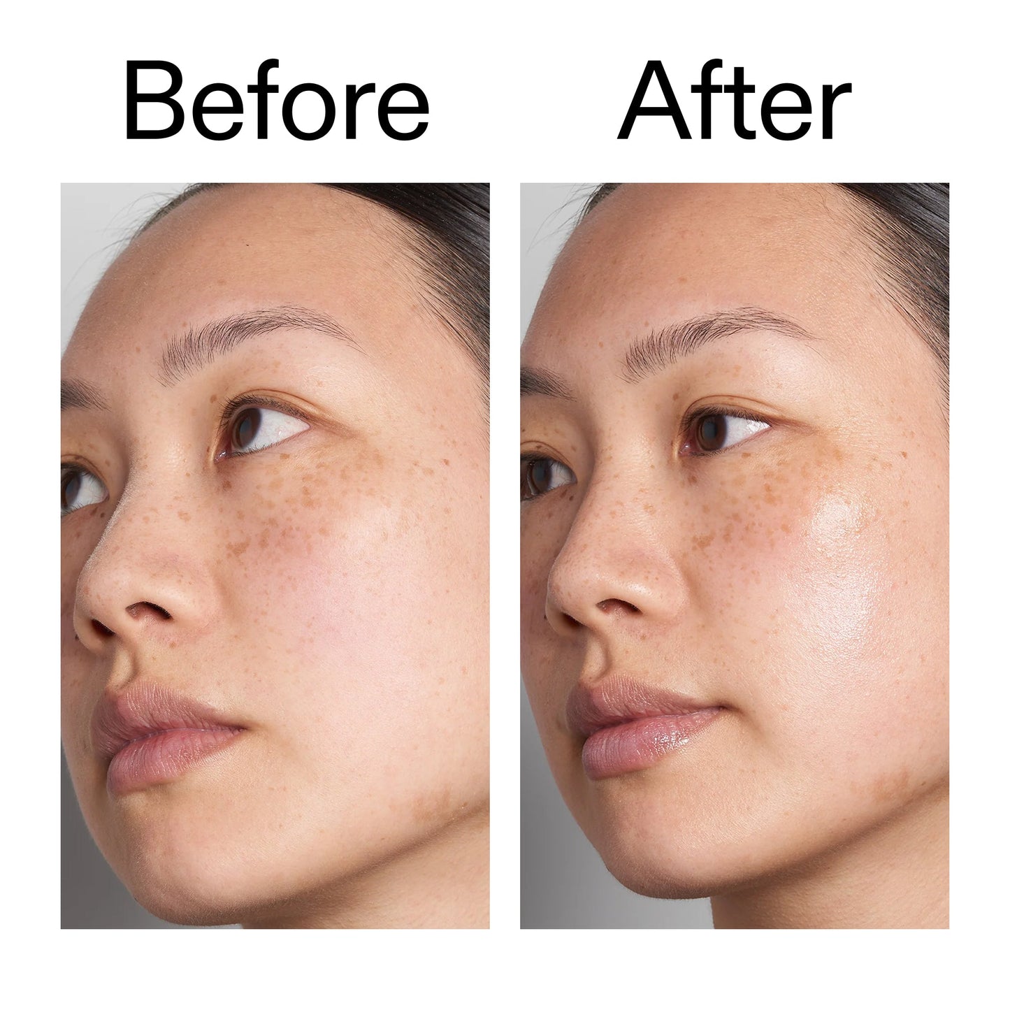 hyaluronic-acid-serum-60ml-duo-g2 Hyaluronic_Acid_Before_After_2000x2000_d566f5ba-a77e-4585-99fd-0f4682b164dd.jpg