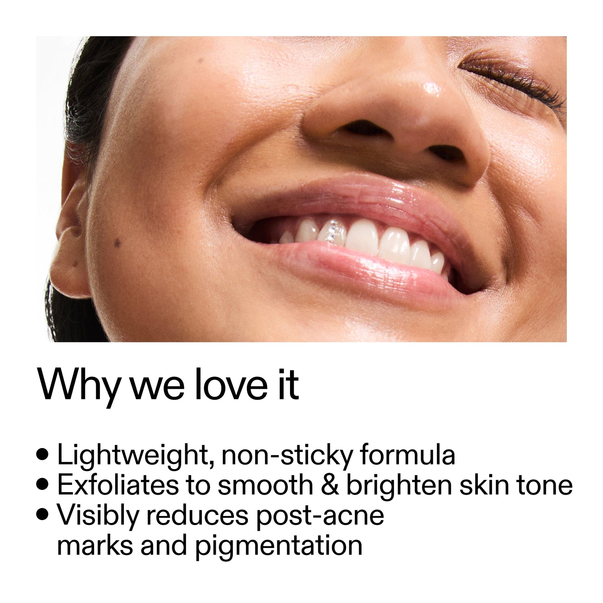 mandelic-acid-treatment-e7 Mandelic_Acid_Treatment_Why_we_love_it_2000x2000_6dfe29a9-2a79-464f-a5e8-e5ac37d93388.jpg