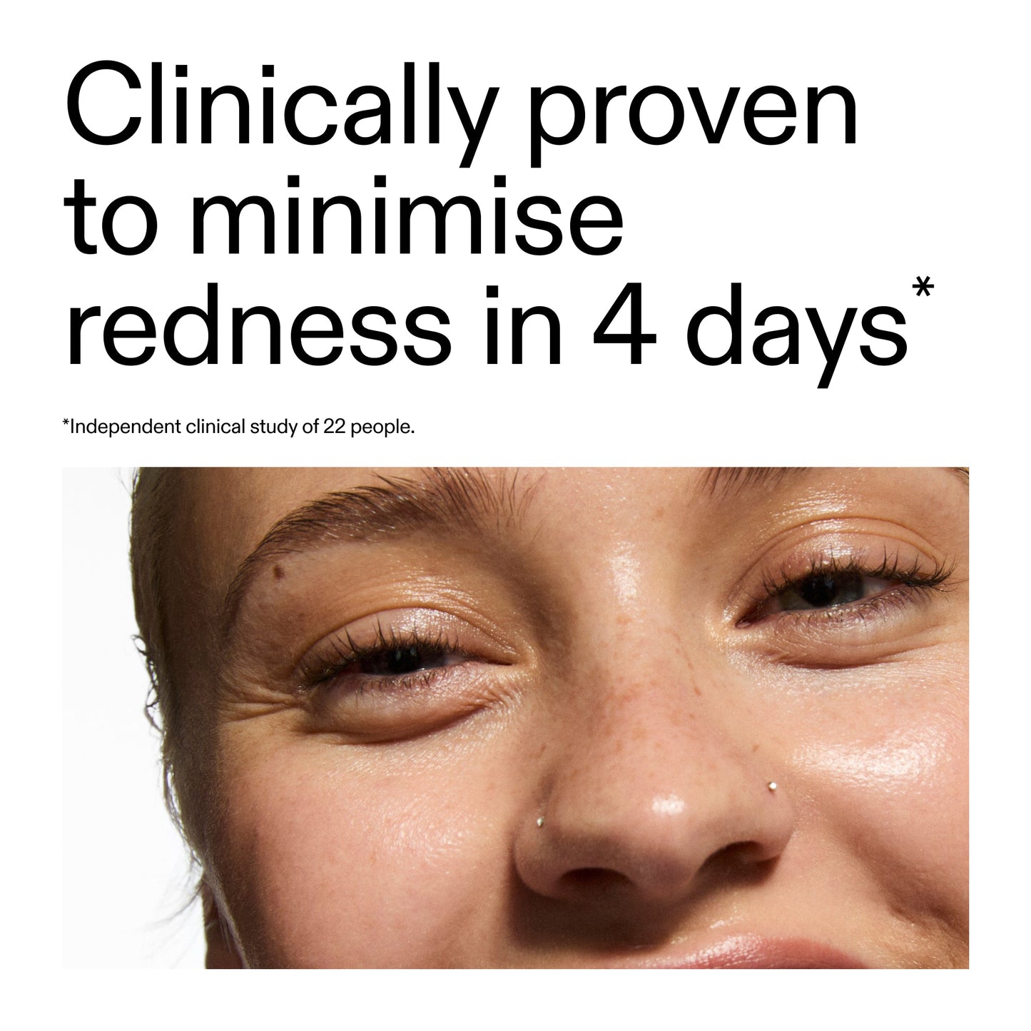 10-azelaic-acid-serum-for-redness-relief-a2 Oat_Cleansing_Balm_Claim_2000x2000_52a841dc-353c-4f2c-8646-3aadb604507d.jpg