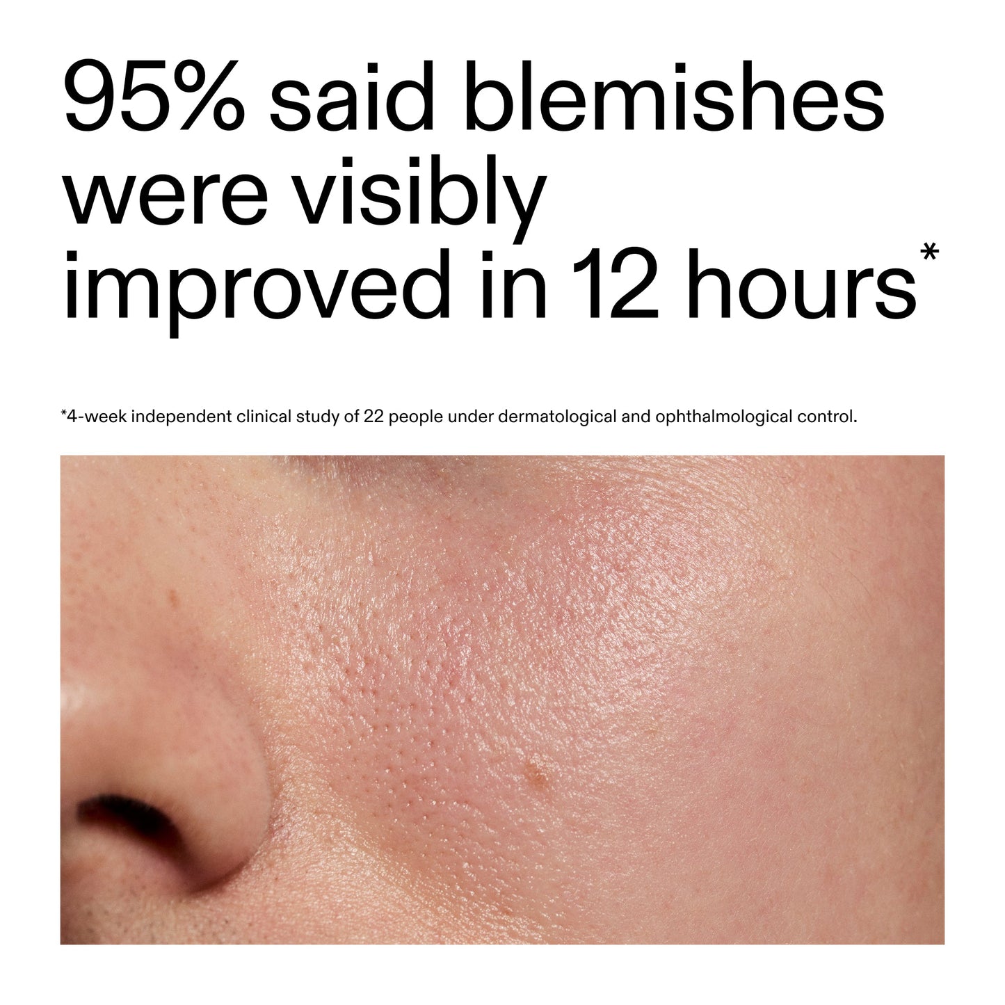 succinic-acid-acne-treatment-e6 Oat_Cleansing_Balm_Claim_2000x2000_ac6ce553-25db-41b2-a981-faae1ac4b8c0.jpg