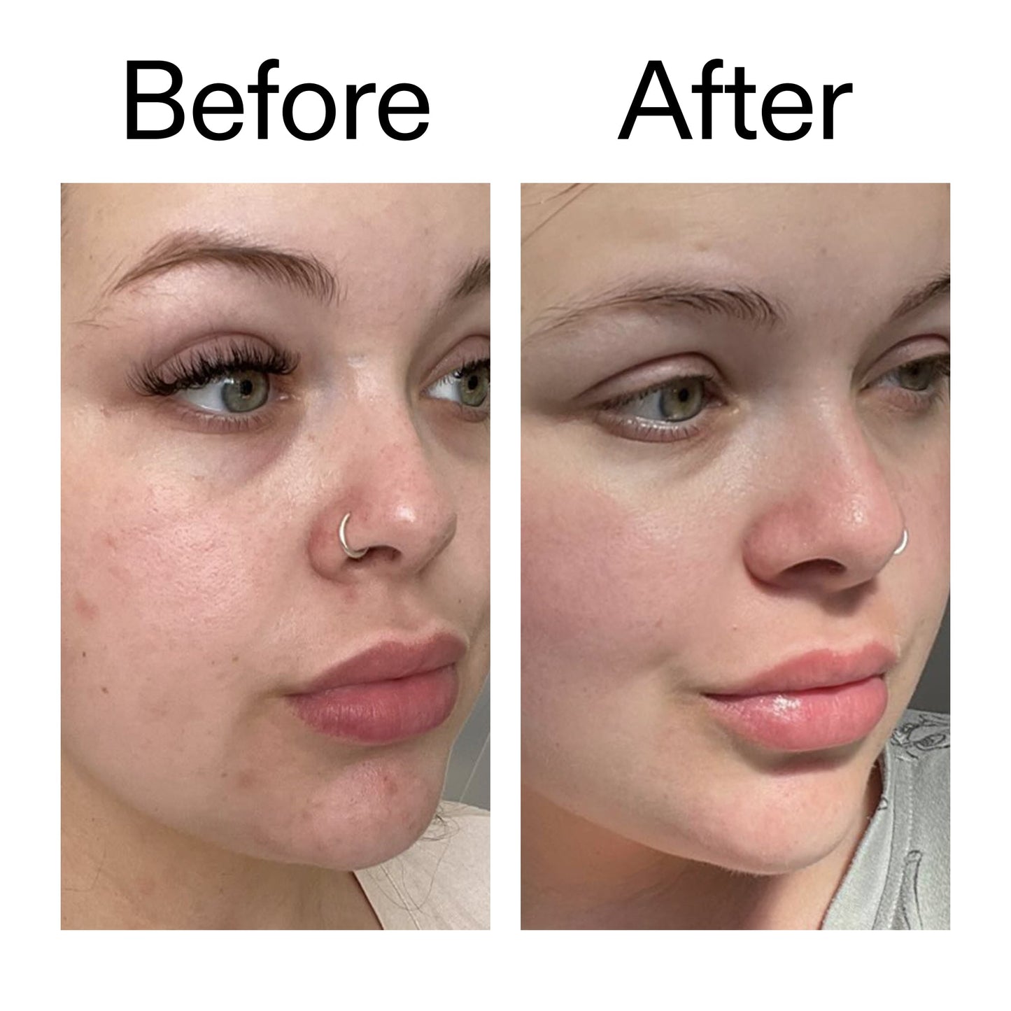 supersize-omega-water-cream-duo-g3 Omega50_Before_After_2000x2000_46483ed8-3f9d-487f-9a0c-9df79830bd65.jpg