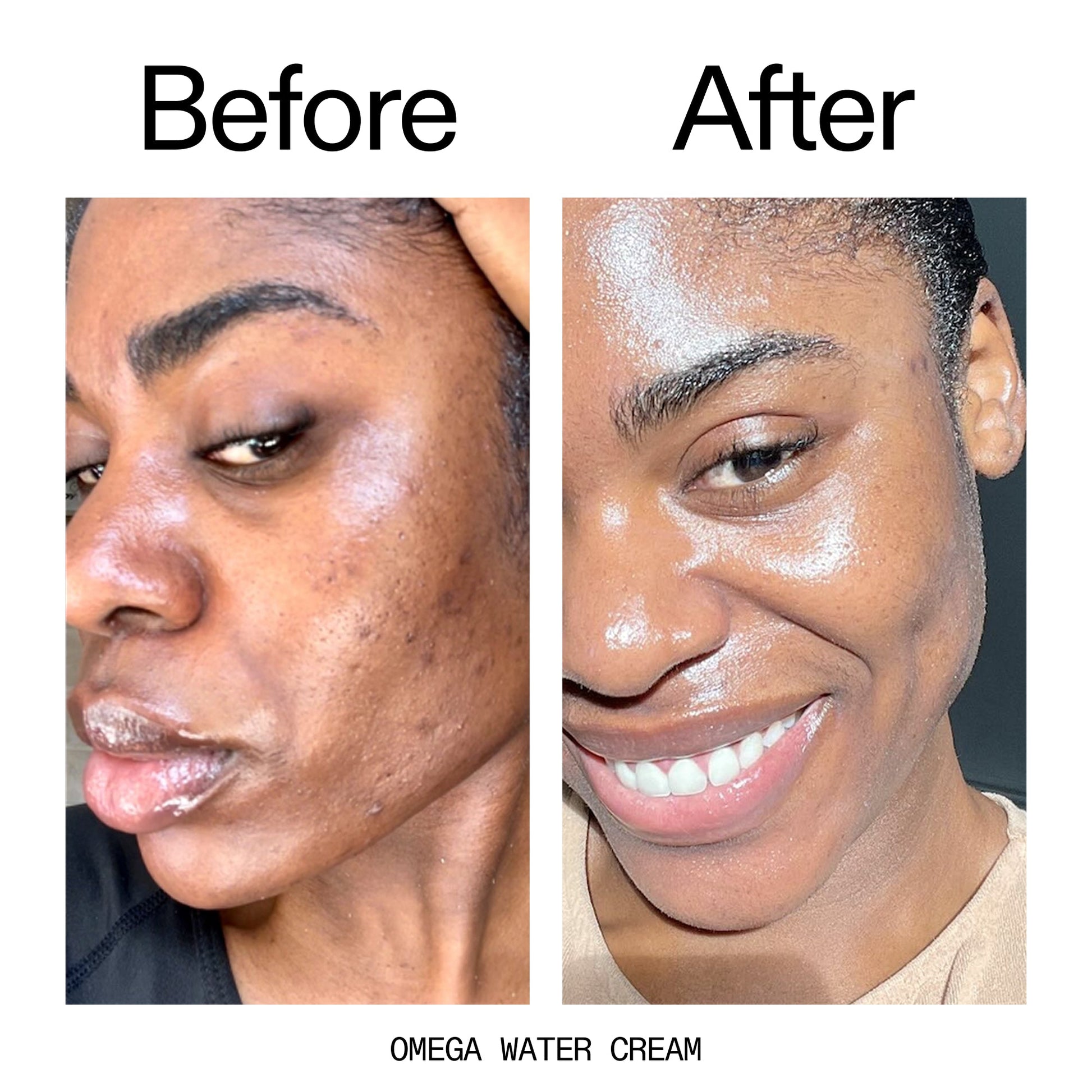 glowing-skin-set-b7 Omega_Water_Cream_Before_After_2000x2000_8e88278b-8c8d-48dc-ac77-4e98ebbd1b77.jpg