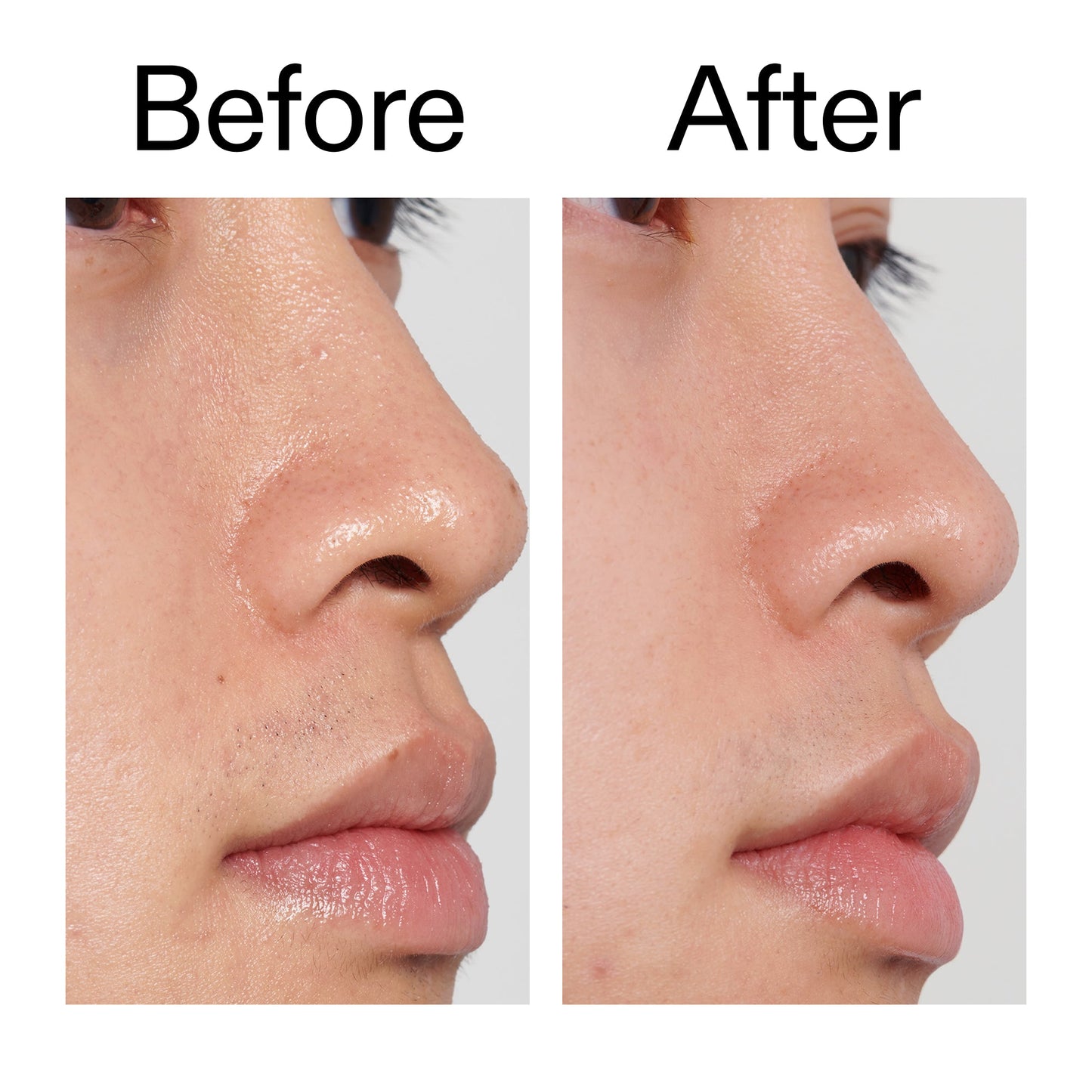 pha-toner-l6 PHA_Toner_Before_After_2000x2000_e3c10172-0150-4342-8b95-57417eaff50d.jpg