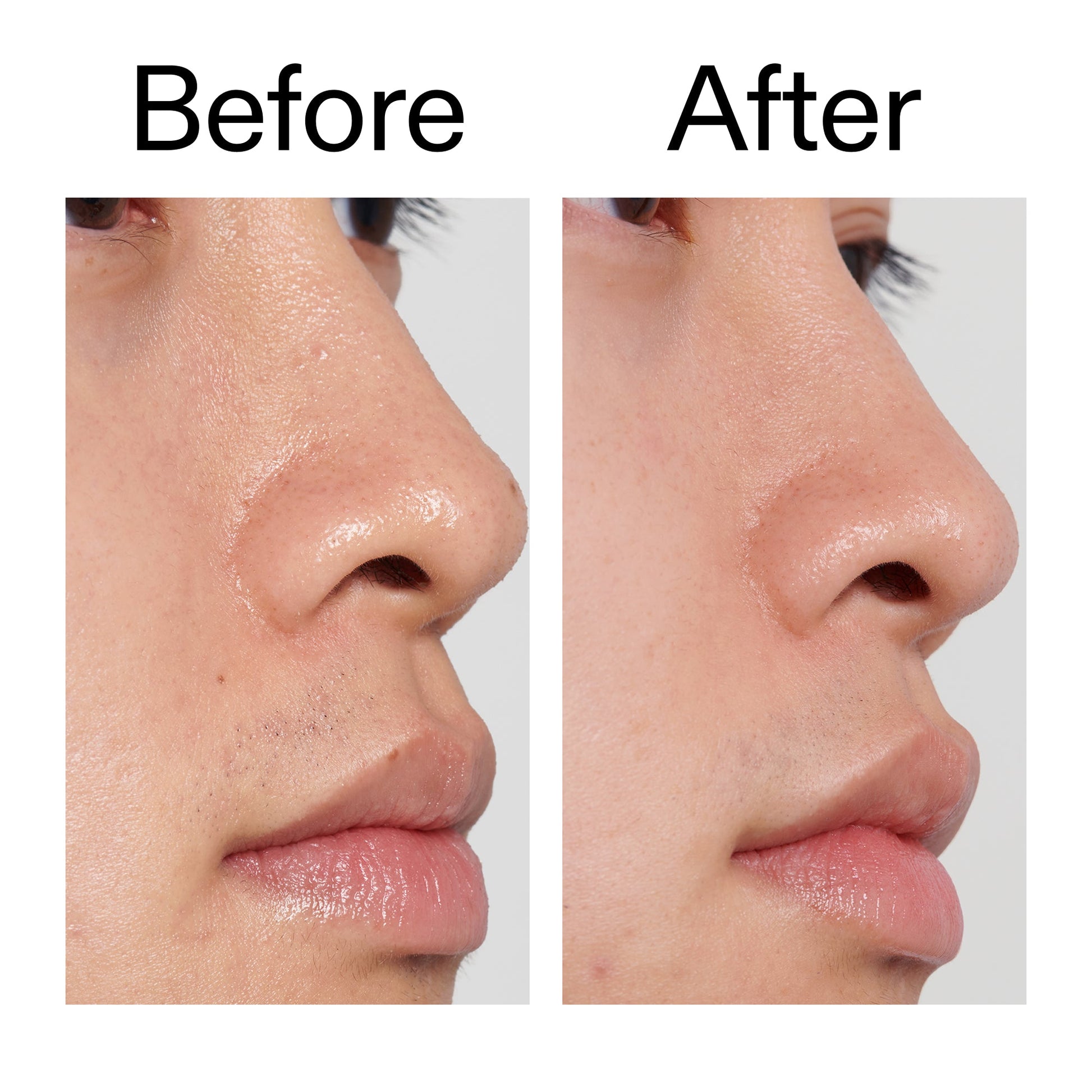 pha-toner-l6 PHA_Toner_Before_After_2000x2000_e3c10172-0150-4342-8b95-57417eaff50d.jpg