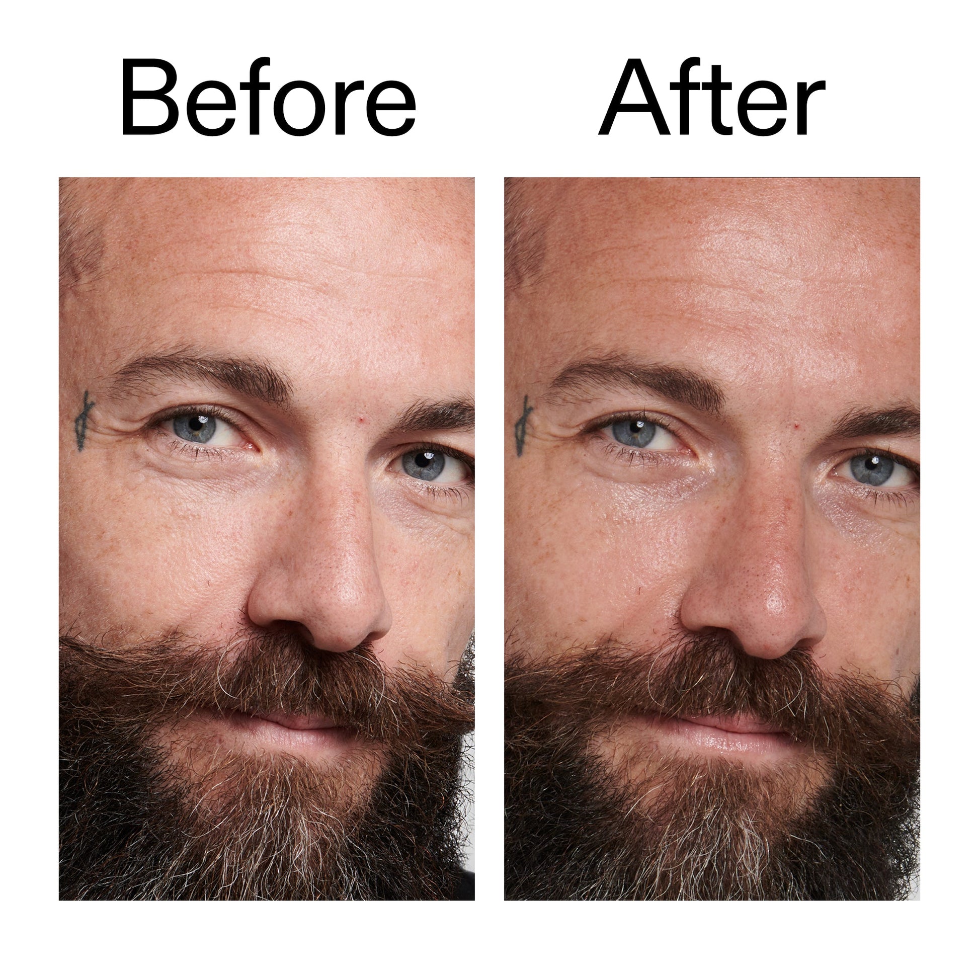 peptide-moisturizer-a5 Peptide_Moisturizer_Before_After_2000x2000_84623fe4-7b72-4f89-8e87-5edb6c752ac5.jpg