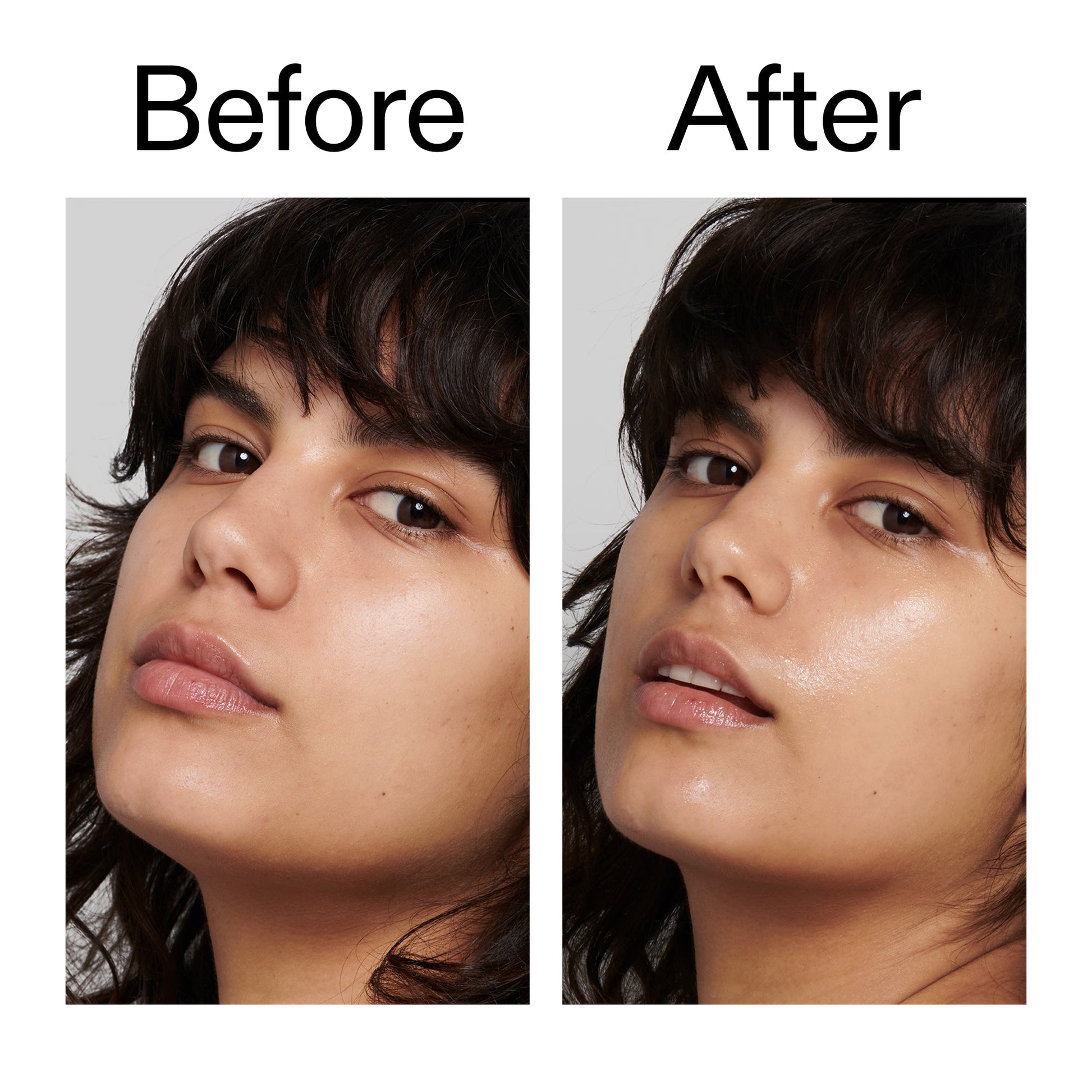 polyglutamic-acid-serum-y7 Polyglutamic_Acid_Serum_Before_After_2000x2000_dc0e1f71-d72b-4358-9c3a-ae43ead715d6.jpg