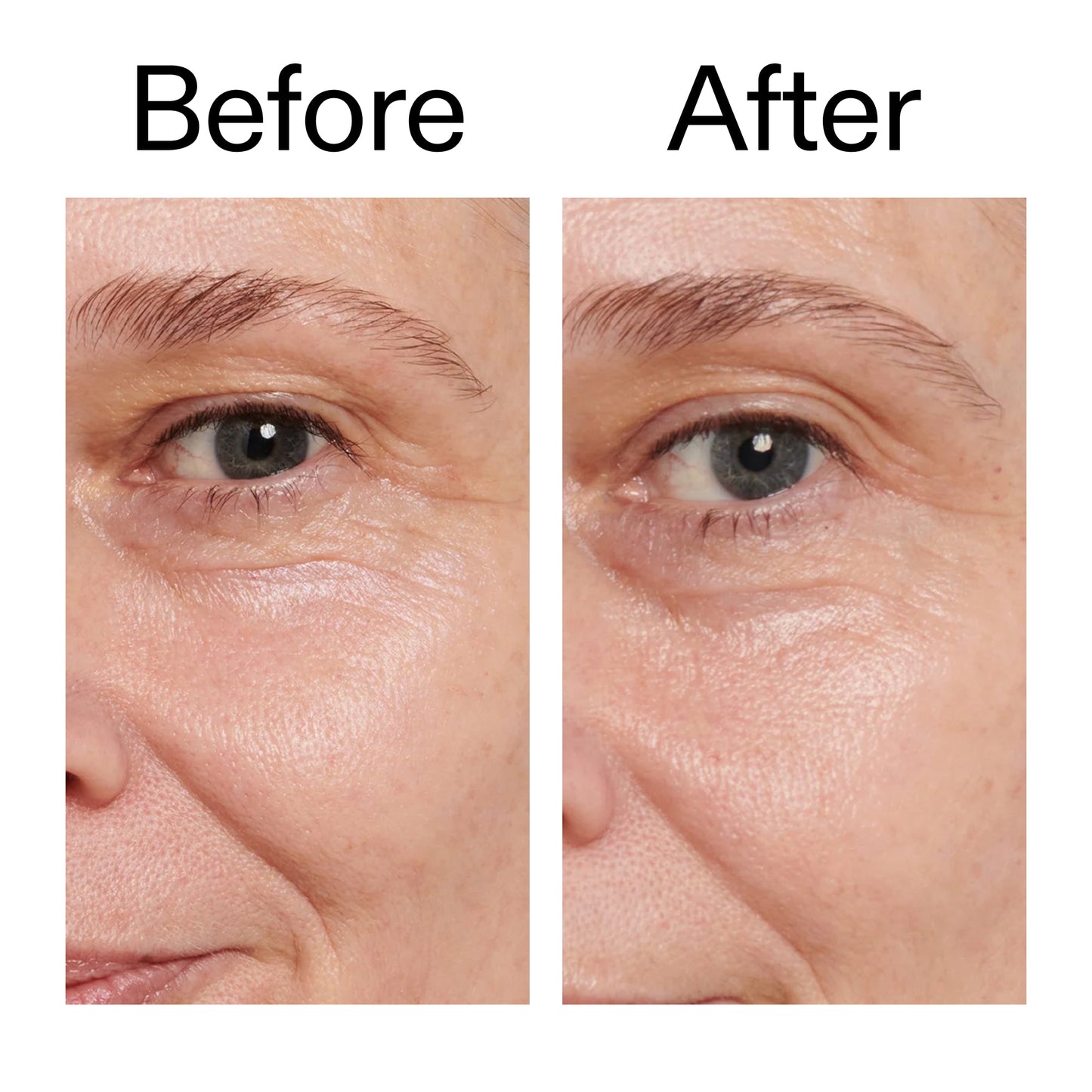 retinol-eye-cream-g3 Retinol_Eye_Cream_Before_After_2000x2000_ac03a80c-109e-4572-a95a-91dc109b4d27.jpg