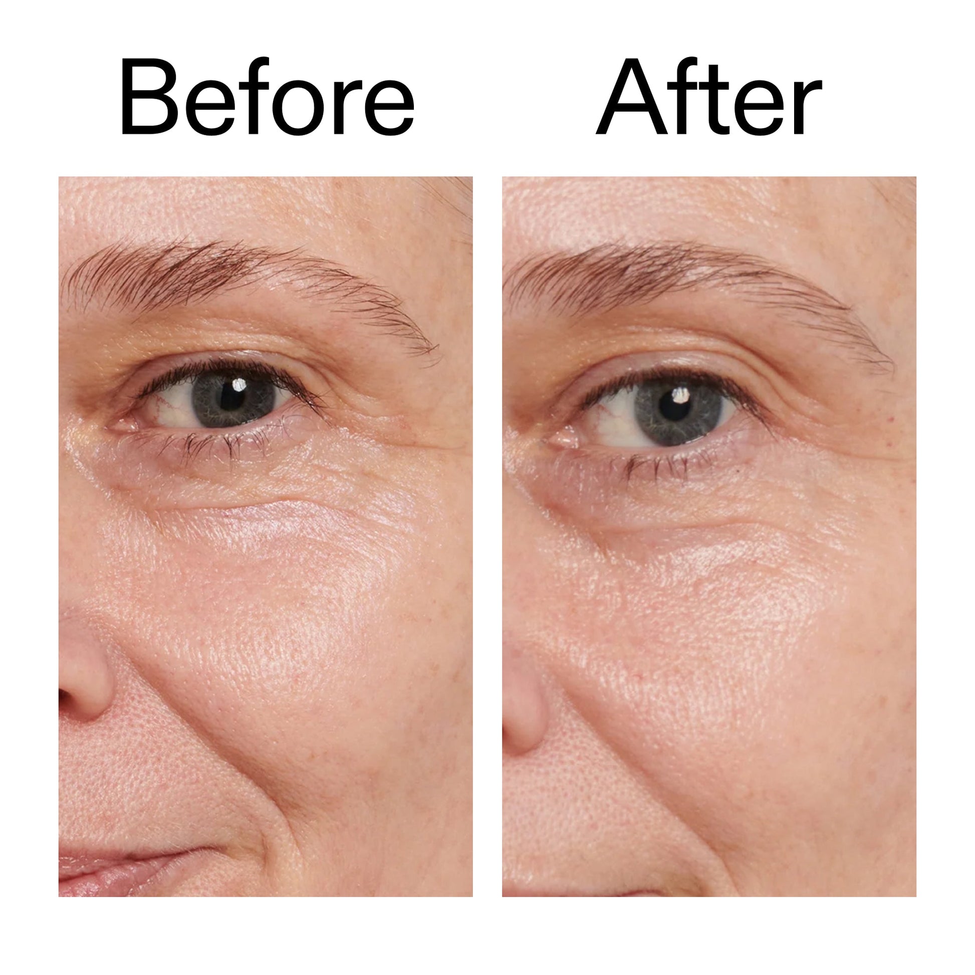 retinol-eye-cream-g3 Retinol_Eye_Cream_Before_After_2000x2000_ac03a80c-109e-4572-a95a-91dc109b4d27.jpg
