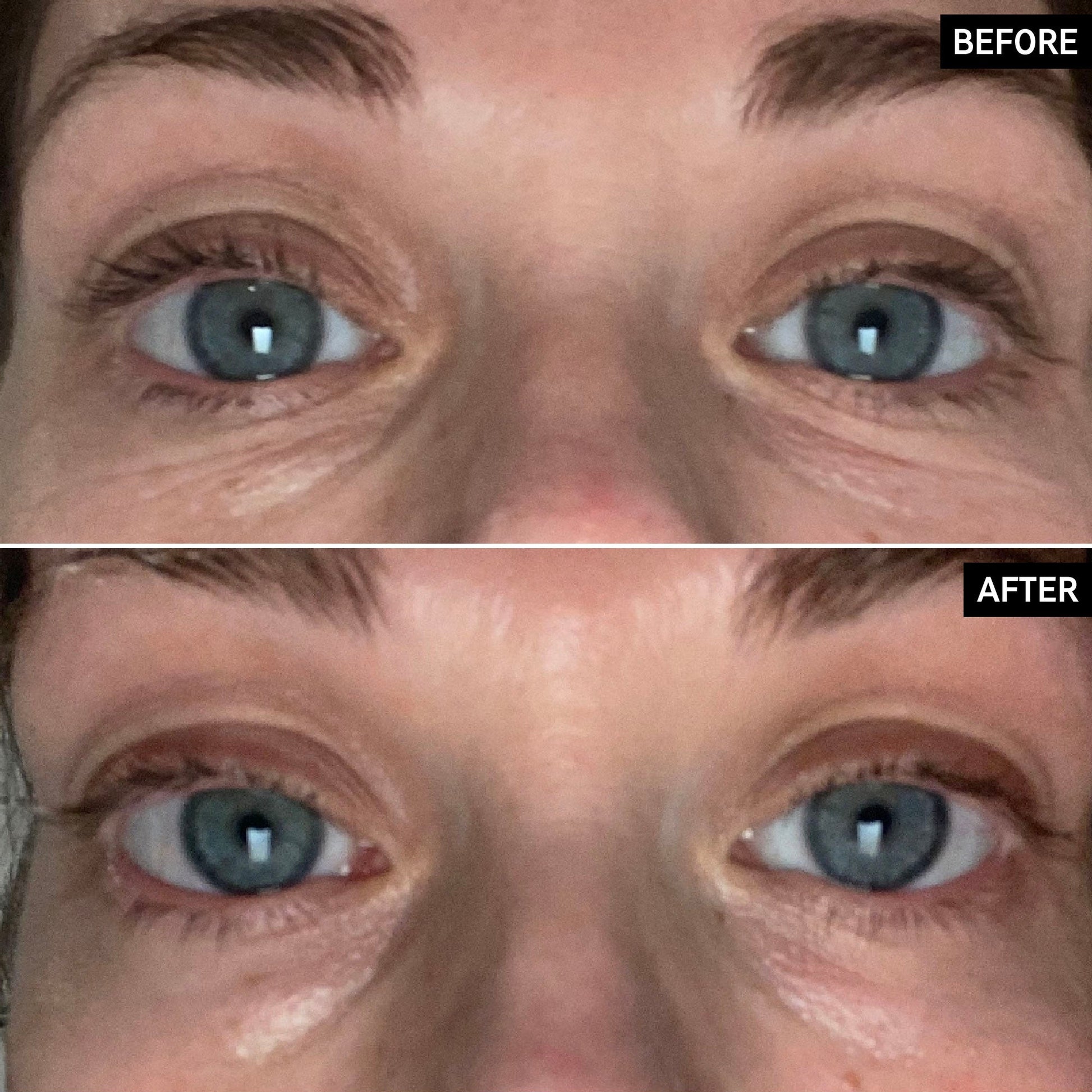 retinol-eye-cream-g3 SITE-UGCBAsApril_Nicole_B_A_PPage_2000x2000_1.jpg