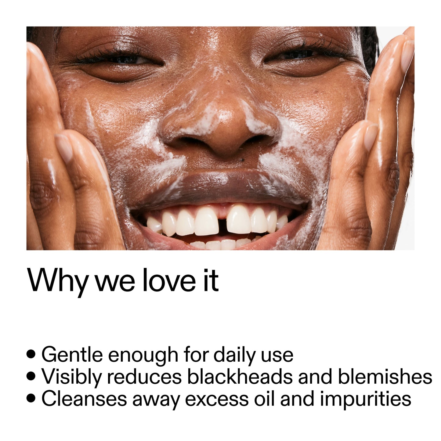 salicylic-acid-cleanser-150ml-f4 Salicylic_Acid_Cleanser_-_300mlWhy_we_love_it_2000x2000_87dc92a9-2559-4309-98cd-4e570f1be735.jpg