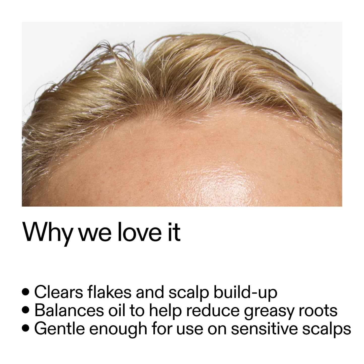 salicylic-acid-exfoliating-scalp-treatment-x0 Salicylic_Acid_Exfoliating_Scalp_Treatment_Why_we_love_it_2000x2000_44b6bd6d-9ec4-4b23-9dc4-bc3fd6f28e14.jpg
