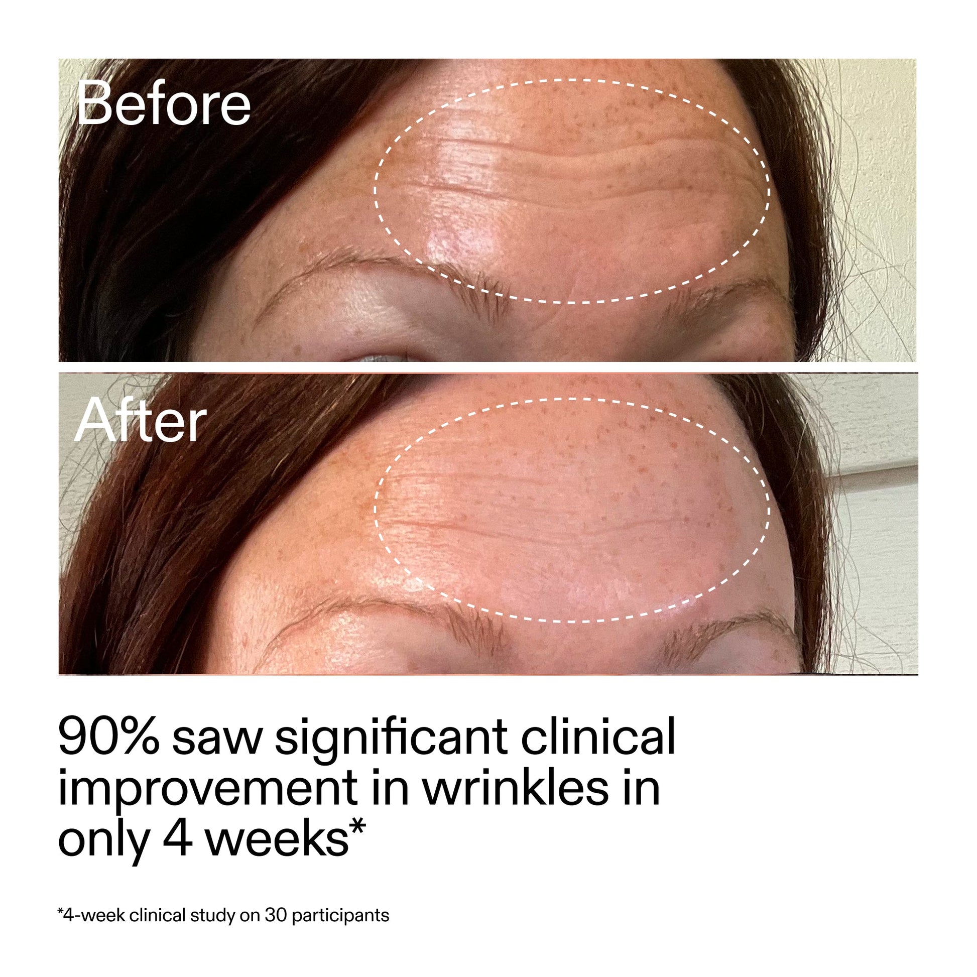 starter-retinol-serum-duo-x6 StarterRetinol_BeforeAfter_Claim1_2000x2000_03b4d6e5-a357-43b9-a855-aba5e35c57f3.jpg