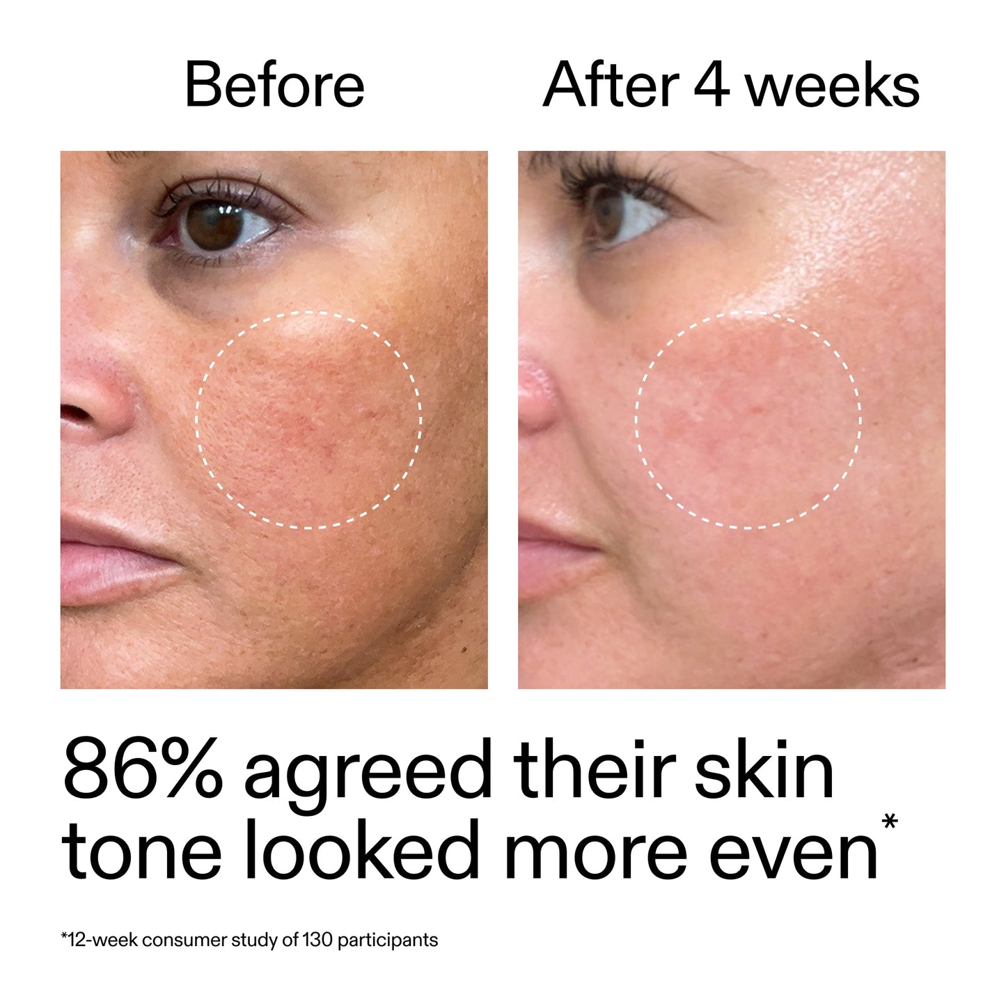 starter-retinol-serum-duo-x6 StarterRetinol_BeforeAfter_Claim2_2000x2000_fc5bb8ac-8588-478f-98d5-28af6651601a.jpg