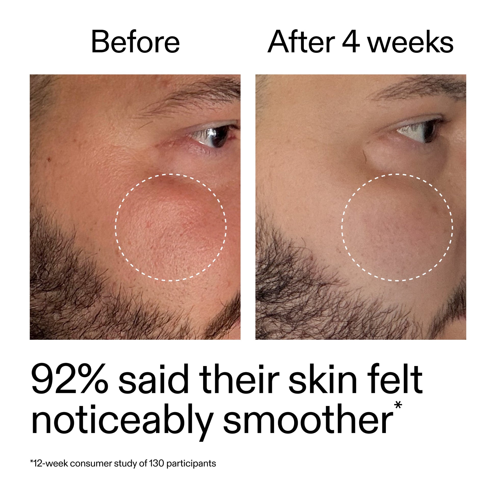 starter-retinol-serum-y7 StarterRetinol_BeforeAfter_Claim3_2000x2000_6ceab106-e0ee-4ed4-ba62-41bc39538038.jpg