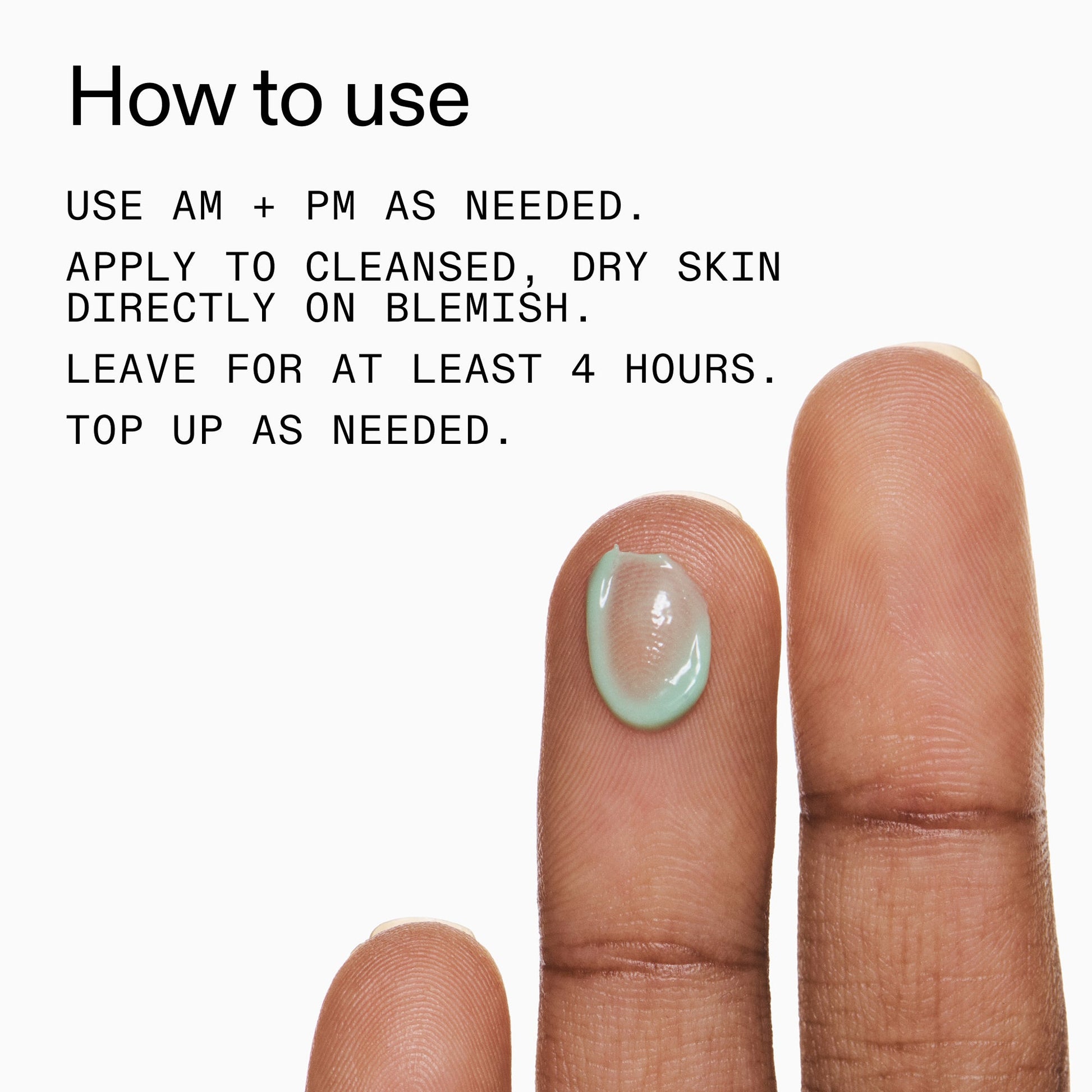 succinic-acid-acne-treatment-e6 Succinic_Acid_Treatment_How_to_Use_2000x2000_d57137d5-d7f1-427c-9a46-5fc00c19c542.jpg