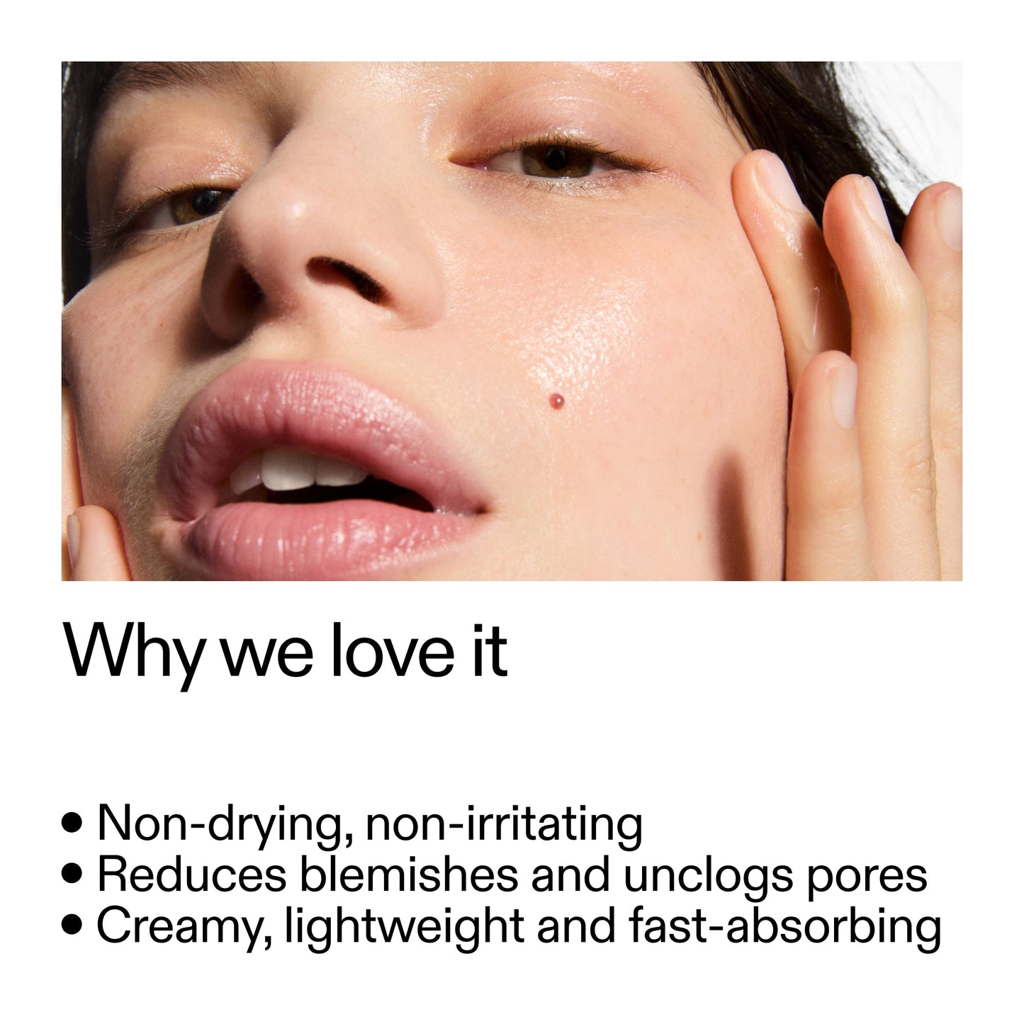 succinic-acid-acne-treatment-e6 Succinic_Acid_Treatment_Why_we_love_it_2000x2000_e90dd42a-cfe9-48b5-a2c7-d5eda787a6a8.jpg