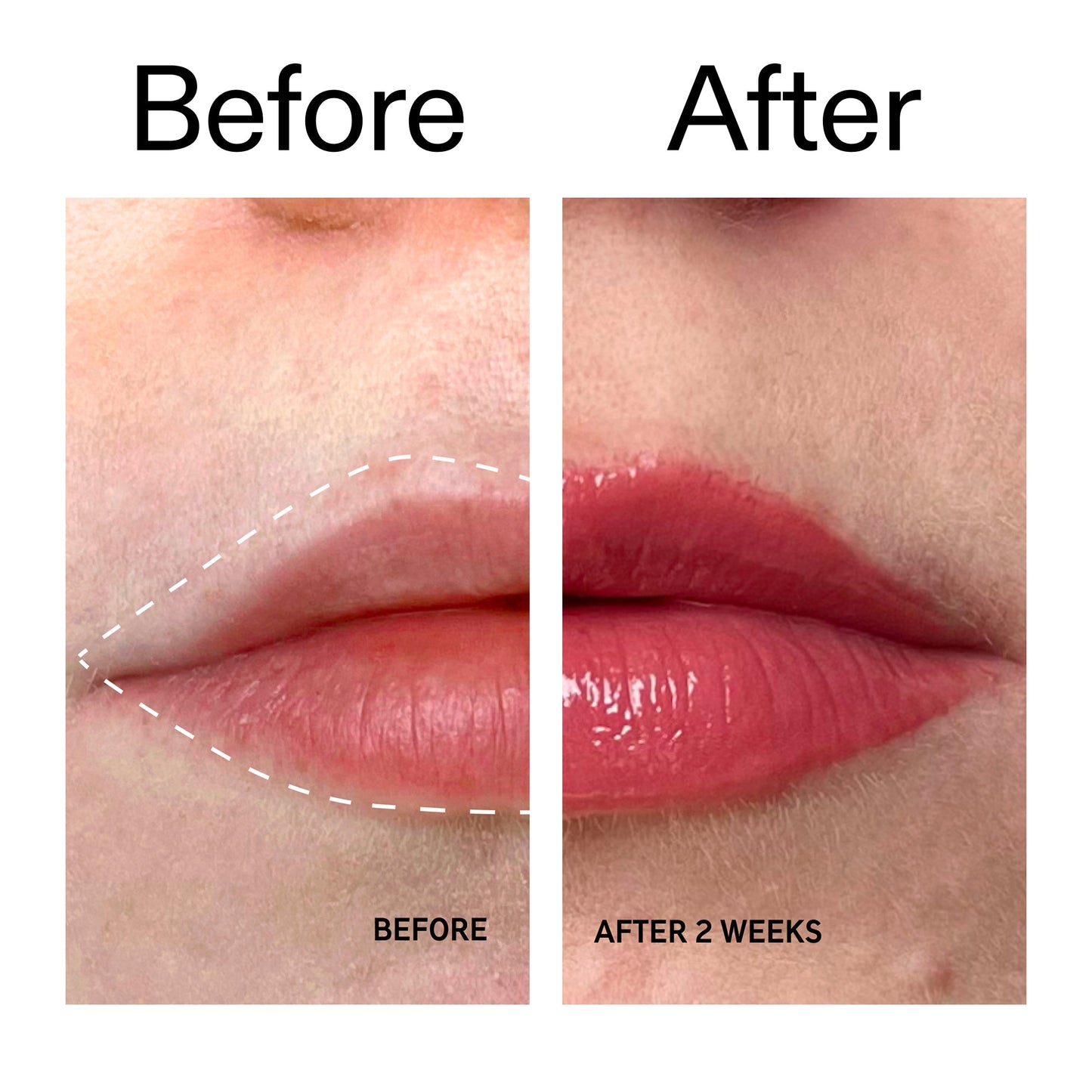 tripeptide-plumping-berry-lip-balm-i0 Tripeptide_Plumping_Lip_Balm_-_Berry_Before_After_2000x2000_9474bbd8-43ca-4b0e-b0e7-dfab70b91927.jpg