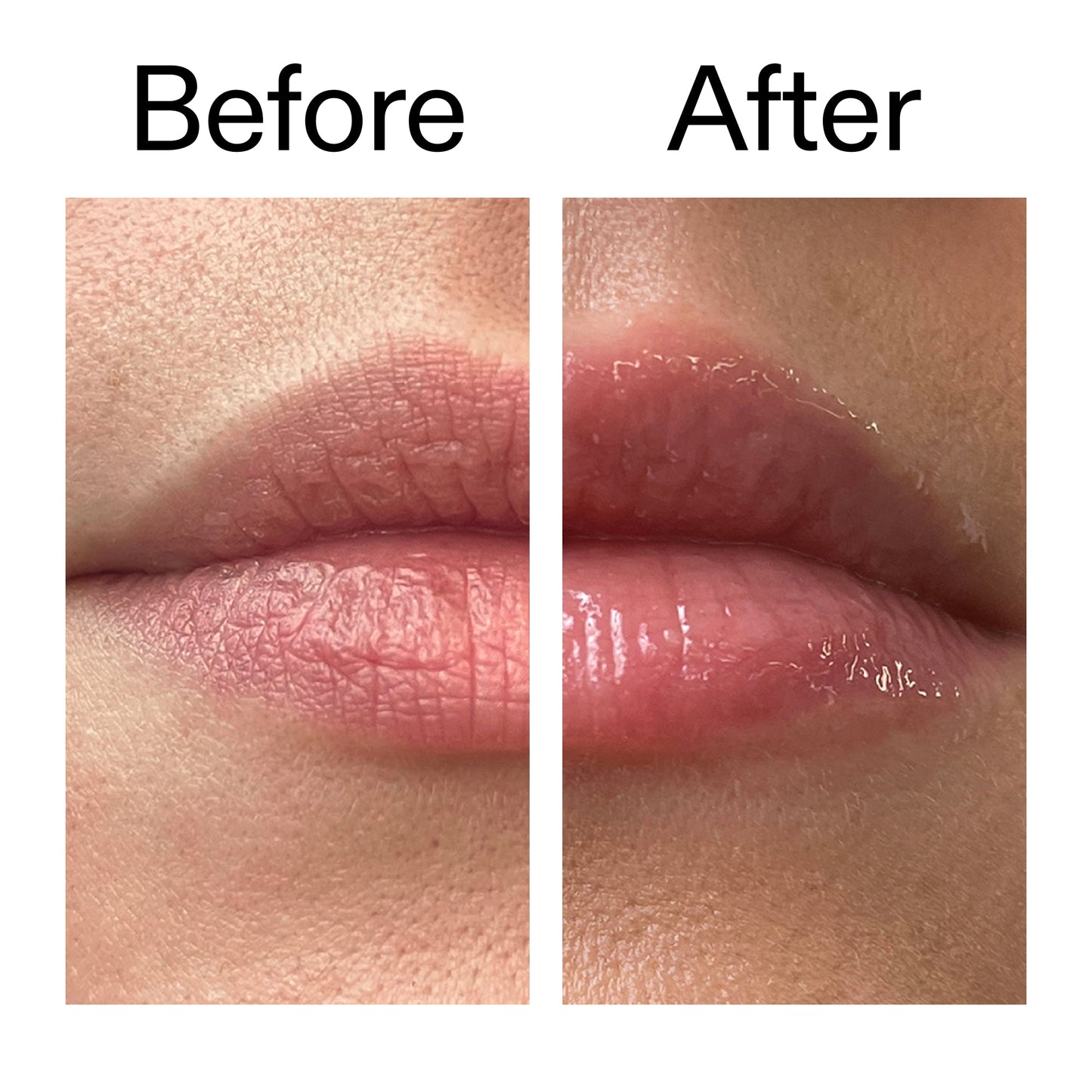 tripeptide-plumping-lip-balm-d5 Tripeptide_Plumping_Lip_Balm_Before_After_2000x2000_b4a5ee04-d2ac-4857-8f01-17209acc4bf3.jpg