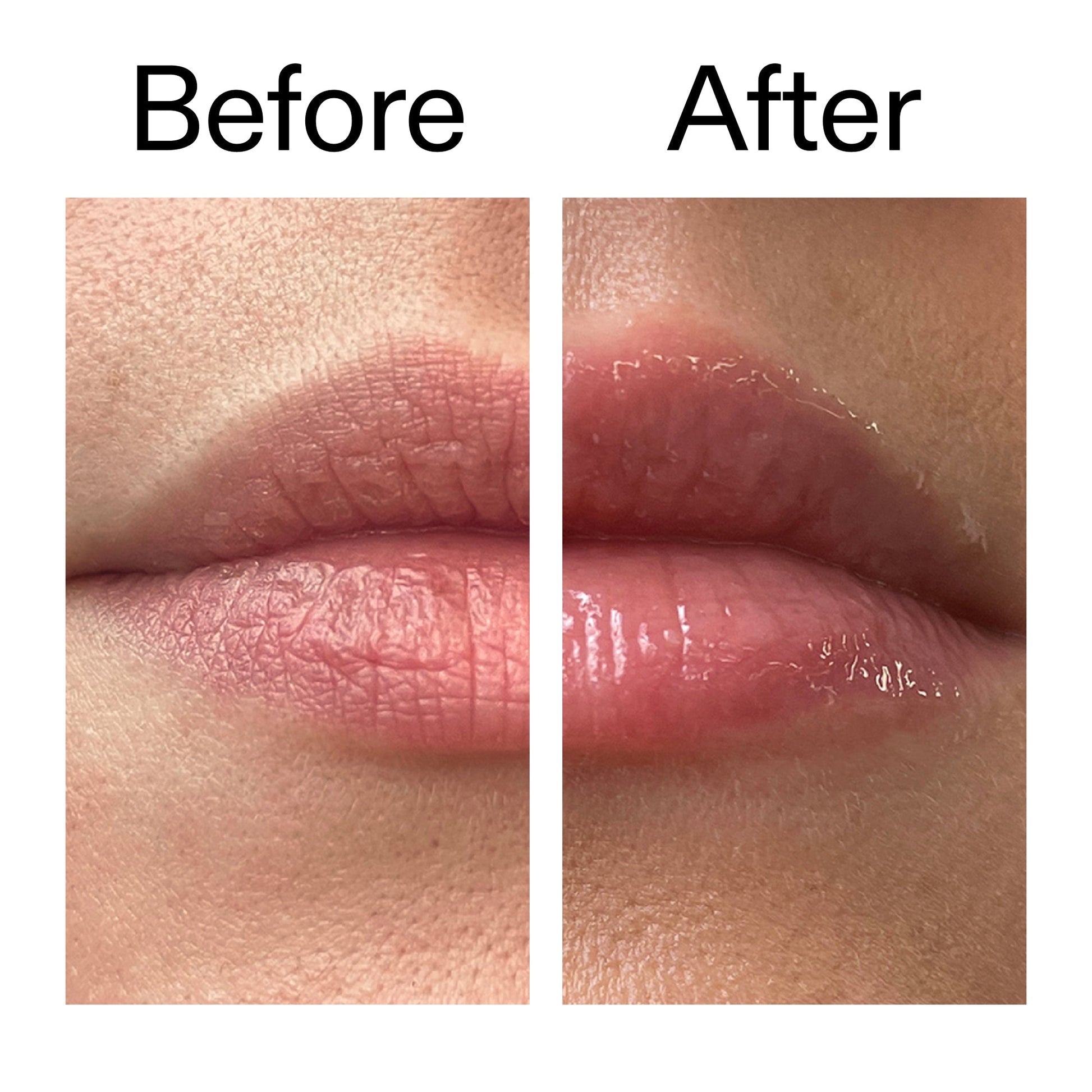 tripeptide-plumping-lip-balm-d5 Tripeptide_Plumping_Lip_Balm_Before_After_2000x2000_b4a5ee04-d2ac-4857-8f01-17209acc4bf3.jpg