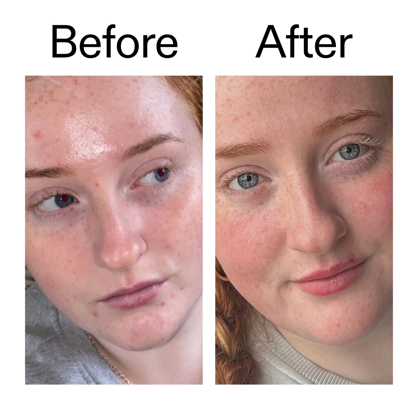 vitamin-b-c-and-e-moisturizer-u3 Vitamin_B_C_and_E_Moisturizer_Before_After_2000x2000_b0781a76-5ad2-4be9-95b8-ef92b356833c.jpg